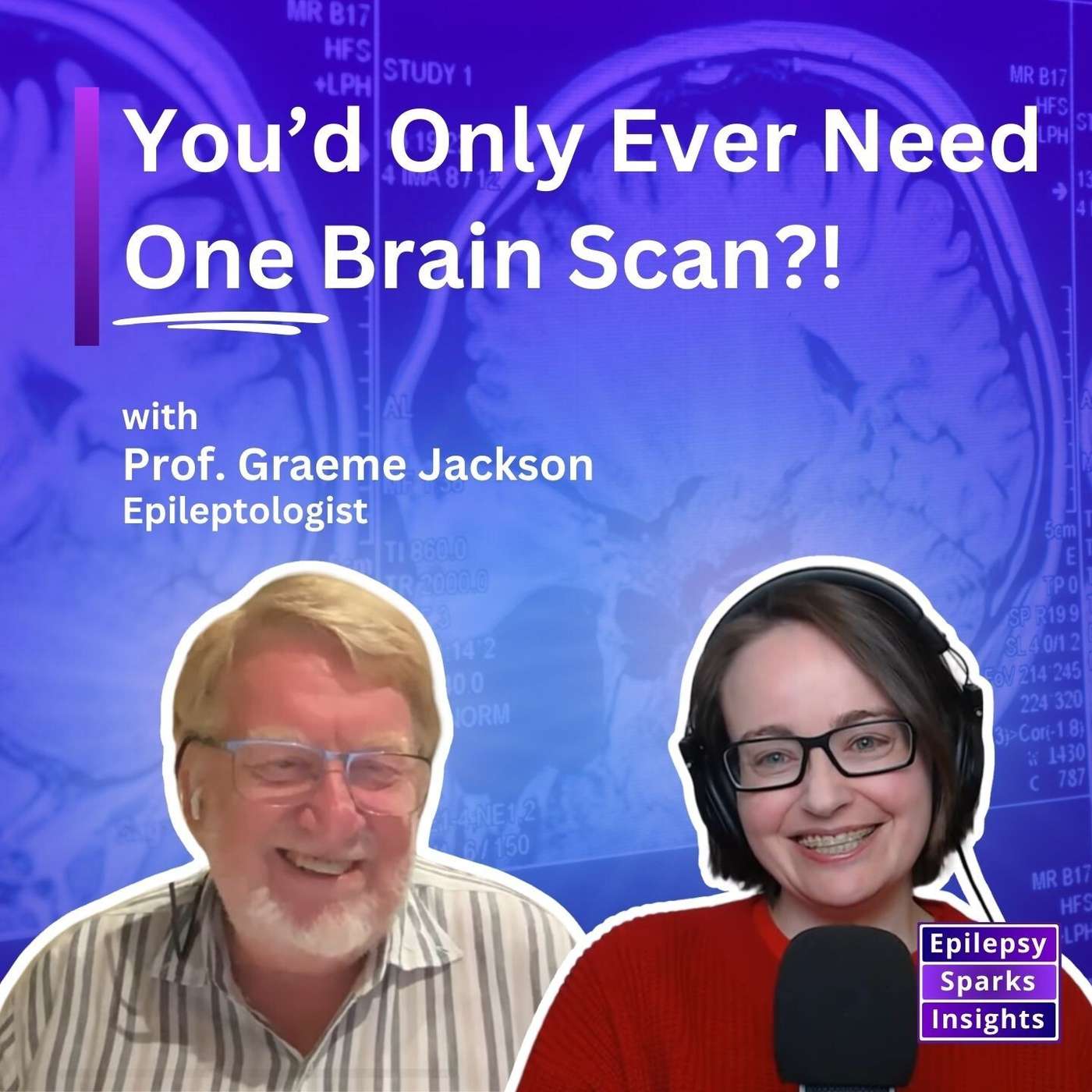 You'll Only Need One Brain Scan For Your Epilepsy! - Graeme Jackson episode artwork
