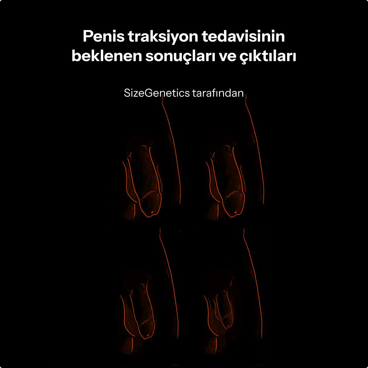 Penil Traksiyon Tedavisi Sonuçları (15+ Klinik Çalışma) | SizeGenetics episode artwork