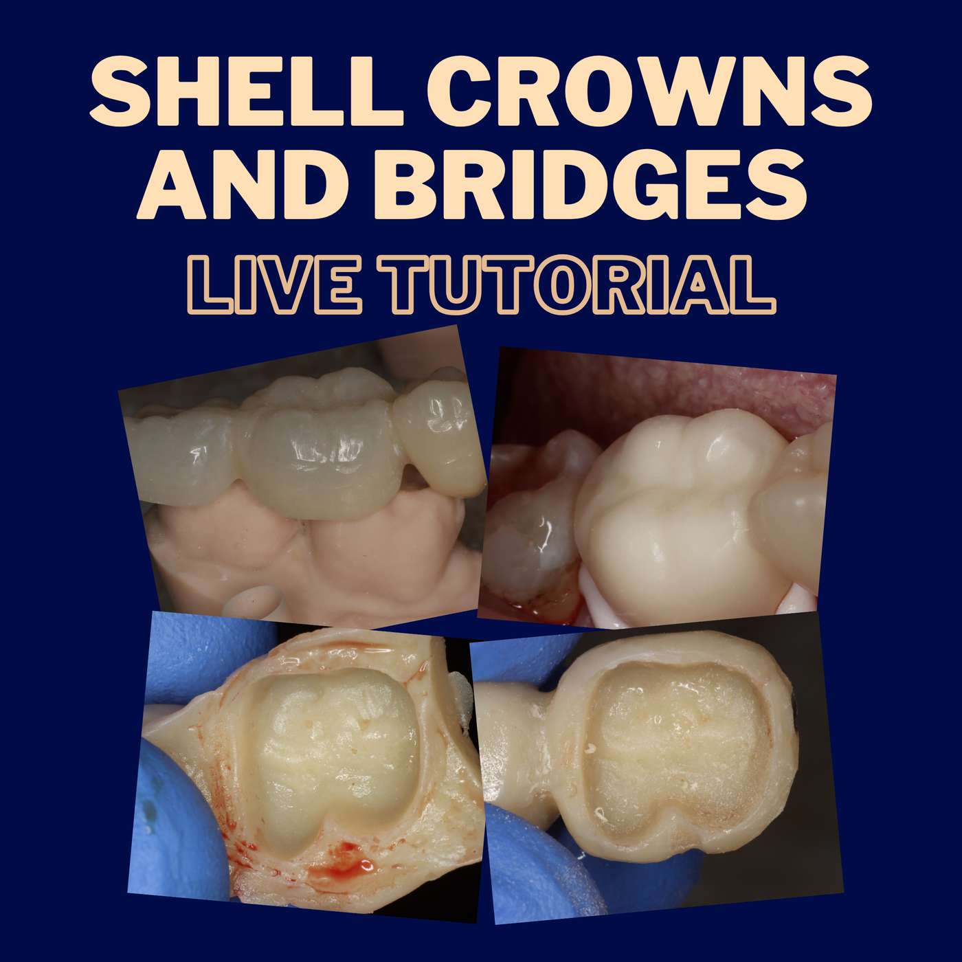 Shell Temporary Crowns with Basil Mizrahi – PDP122 episode artwork