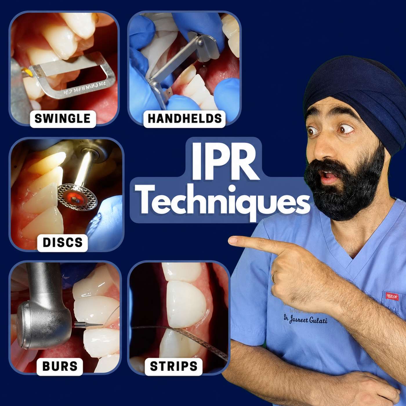 IPR Techniques – Strips vs Burs vs Discs vs Oscillating Handpiece – PDP107 episode artwork