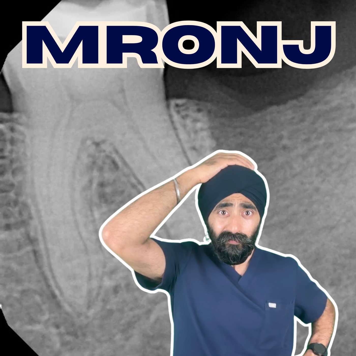 Medication Related Osteonecrosis for GDPs – What You Need to Know (MRONJ) – PDP215 episode artwork