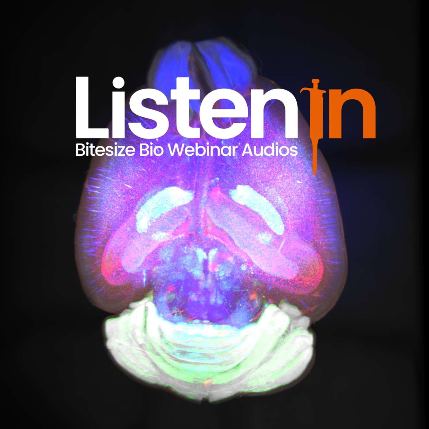 Whole-brain Spatial Transcriptomics at Cellular Resolution Whole-brain Spatial Transcriptomics at Cellular Resolution