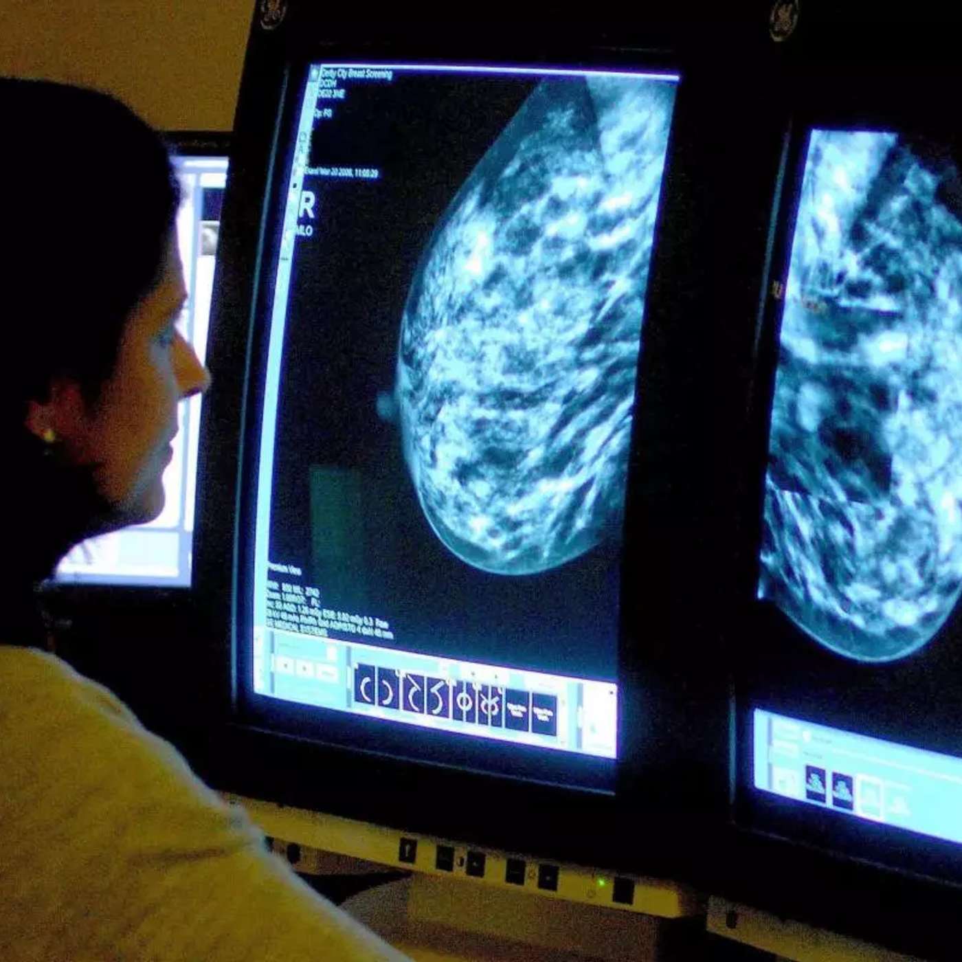 BRAID Trial Enhances Cancer Detection, West Nile Virus Found in UK, Perseverance Rover Marks 1500 Sols, Dementia Rates Decline Yet Prevalence Rises, and more...