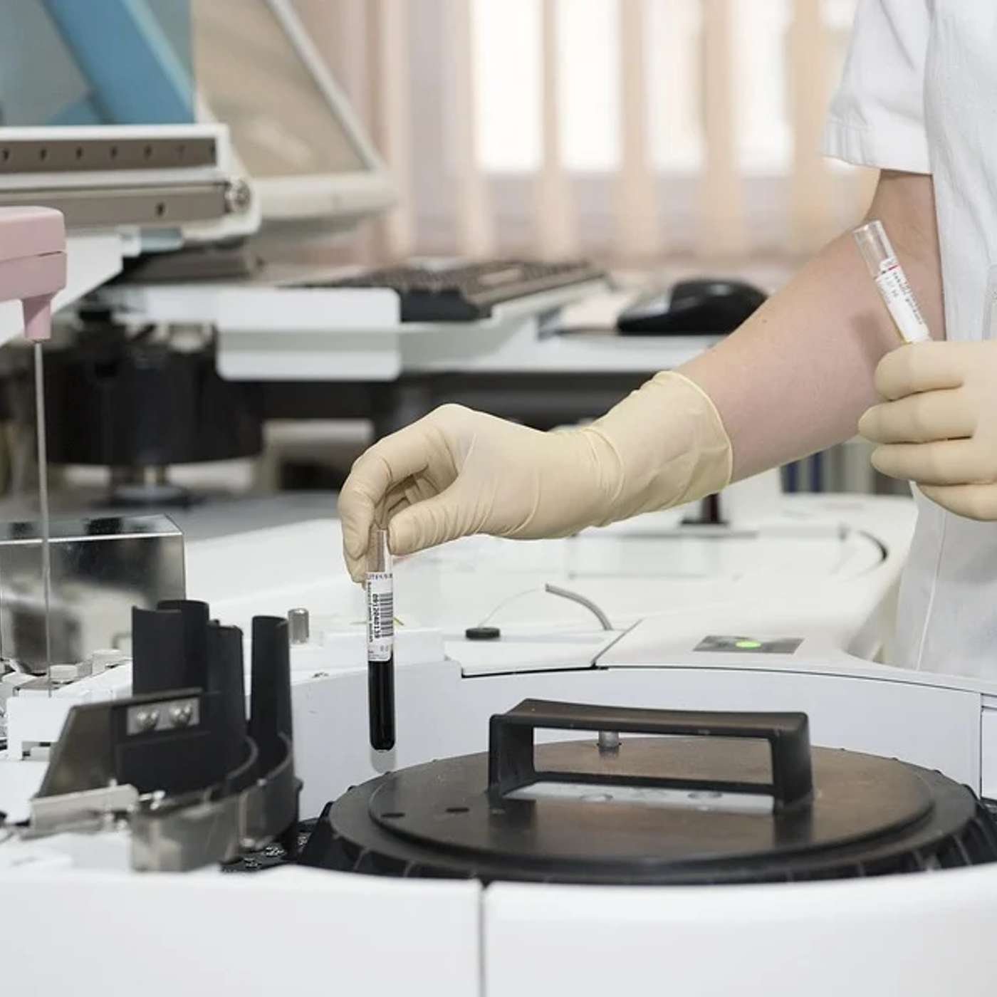 Cell Therapy Replaces Transplants, Ancient Blood Cells Linked to Cancer, China Tests Stem Cell Embryos in Space, BMI Speeds Senior Decline, and more...