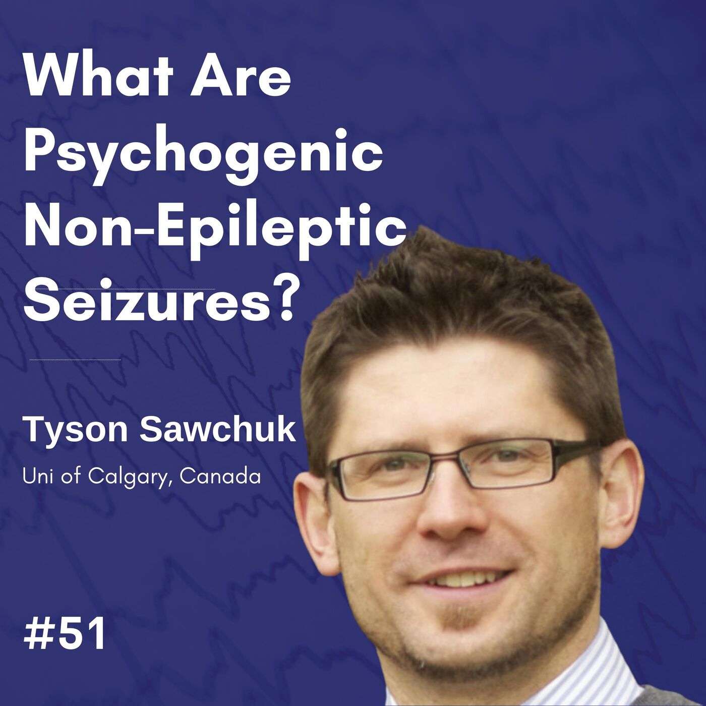 What Are Psychogenic Non-Epileptic Seizures? - Tyson Sawchuk episode artwork