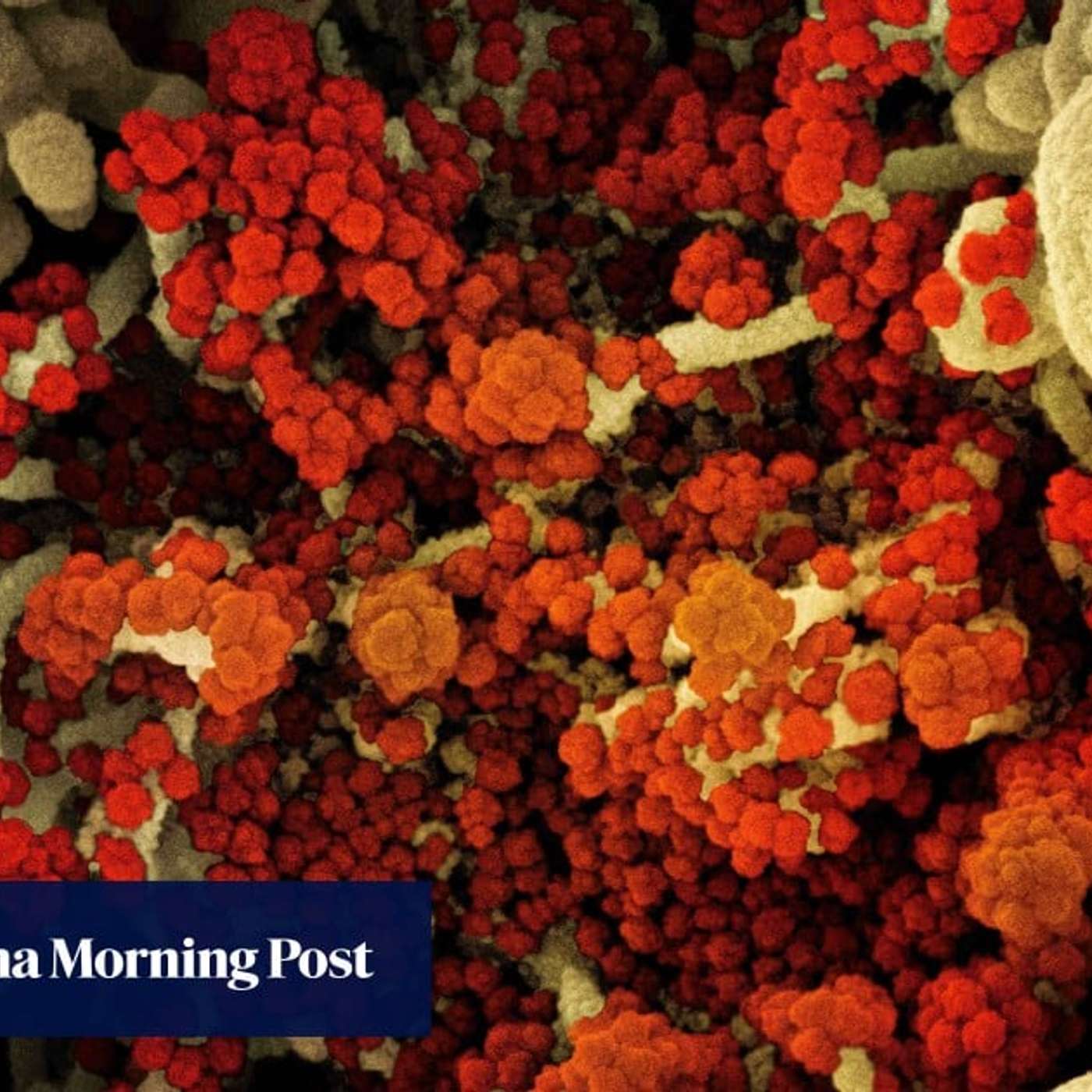 Man battles COVID for 613 days, Protein and Mitochondrial Link Discovered, Giant UK Ichthyosaur Unearthed, STI Key to Africa's Future, and more...