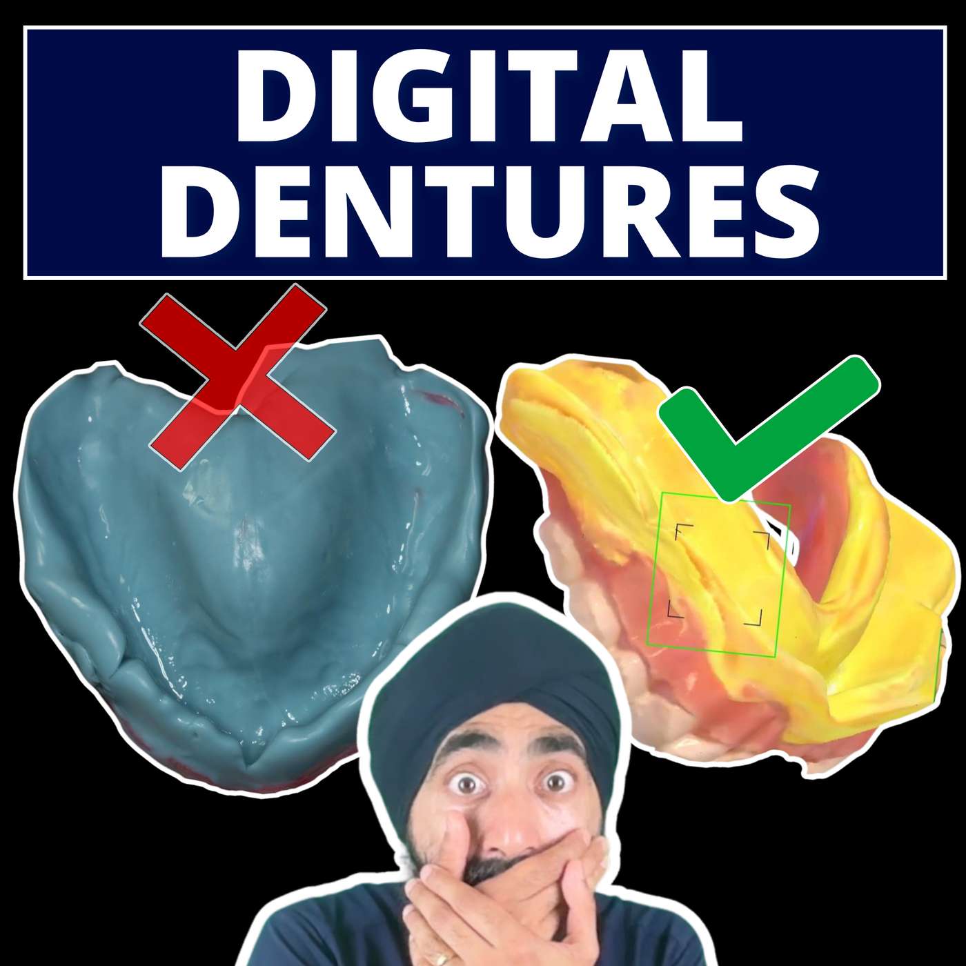 Digital Dentures for Every Dentist – The Death of Impressions? – PDP195 episode artwork