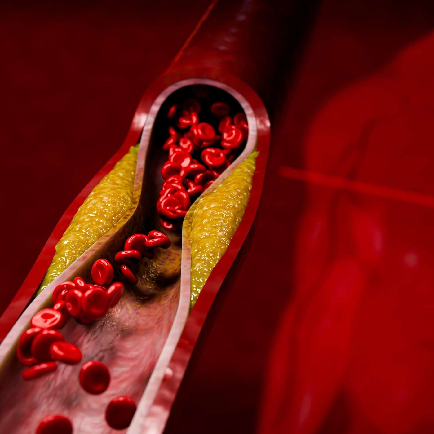 Troponin-Negative Chest Pain: A Dangerous Illusion