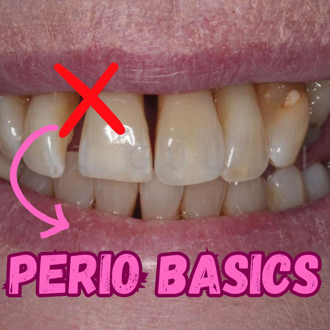 Periodontics for Beginners – PS008 episode artwork