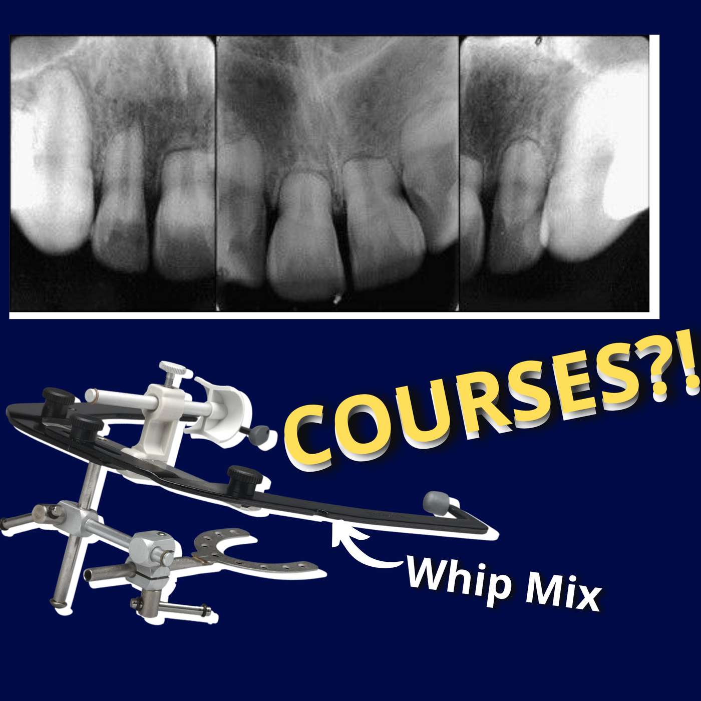 #AskJaz – Picking Courses, Reduce Root Resorption Risk, Treatment Options, Which Facebow? – AJ002 episode artwork