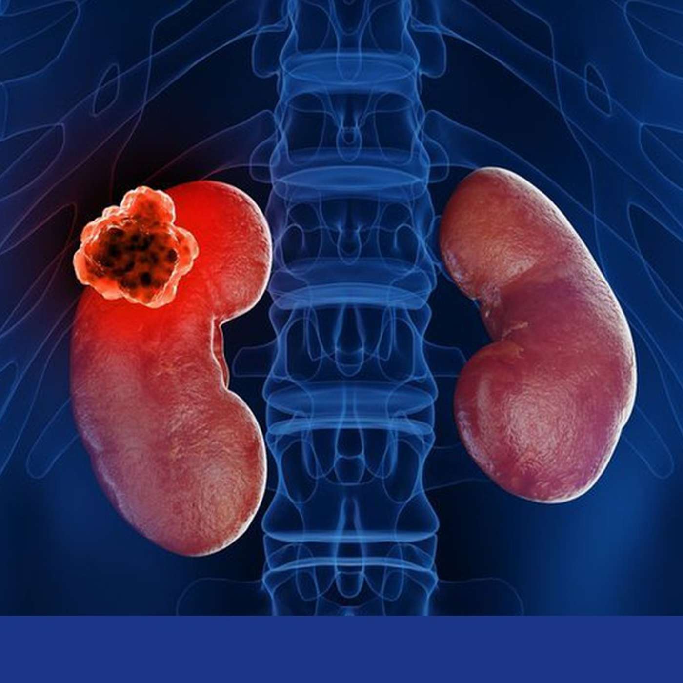 Personalized Cancer Vaccine Breakthrough, Oxford Achieves Quantum Computing Breakthrough, RNA Transport Breakthrough Unveiled, Breakthrough Neurons Control Eating Behavior, and more...