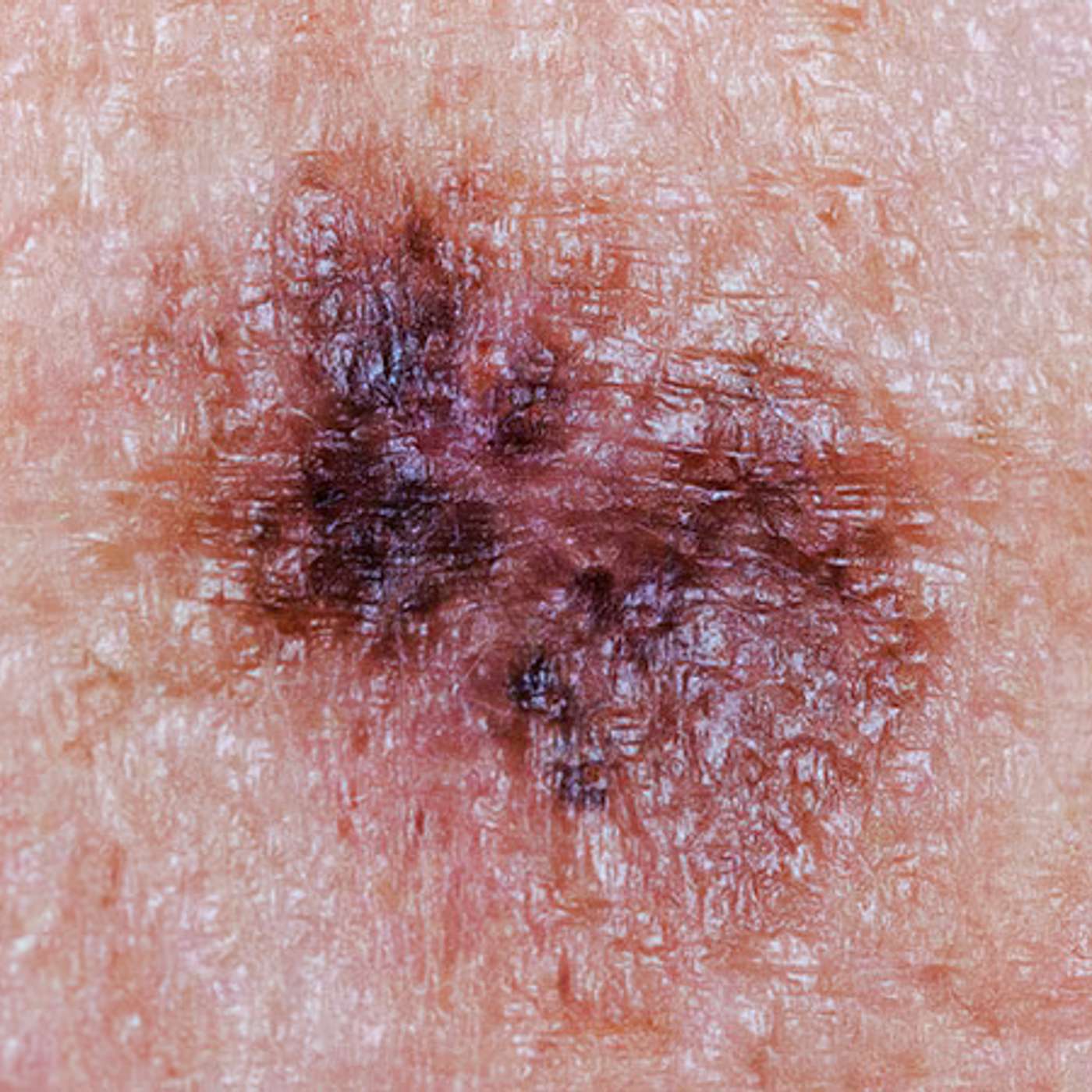 USC UCLA Study Reveals Gut Brain Link, Urgent Action Needed on Antibiotic Resistance, NHS Fast-Tracks Melanoma Trials, Rice Scientists Achieve Quantum Breakthrough, and more...