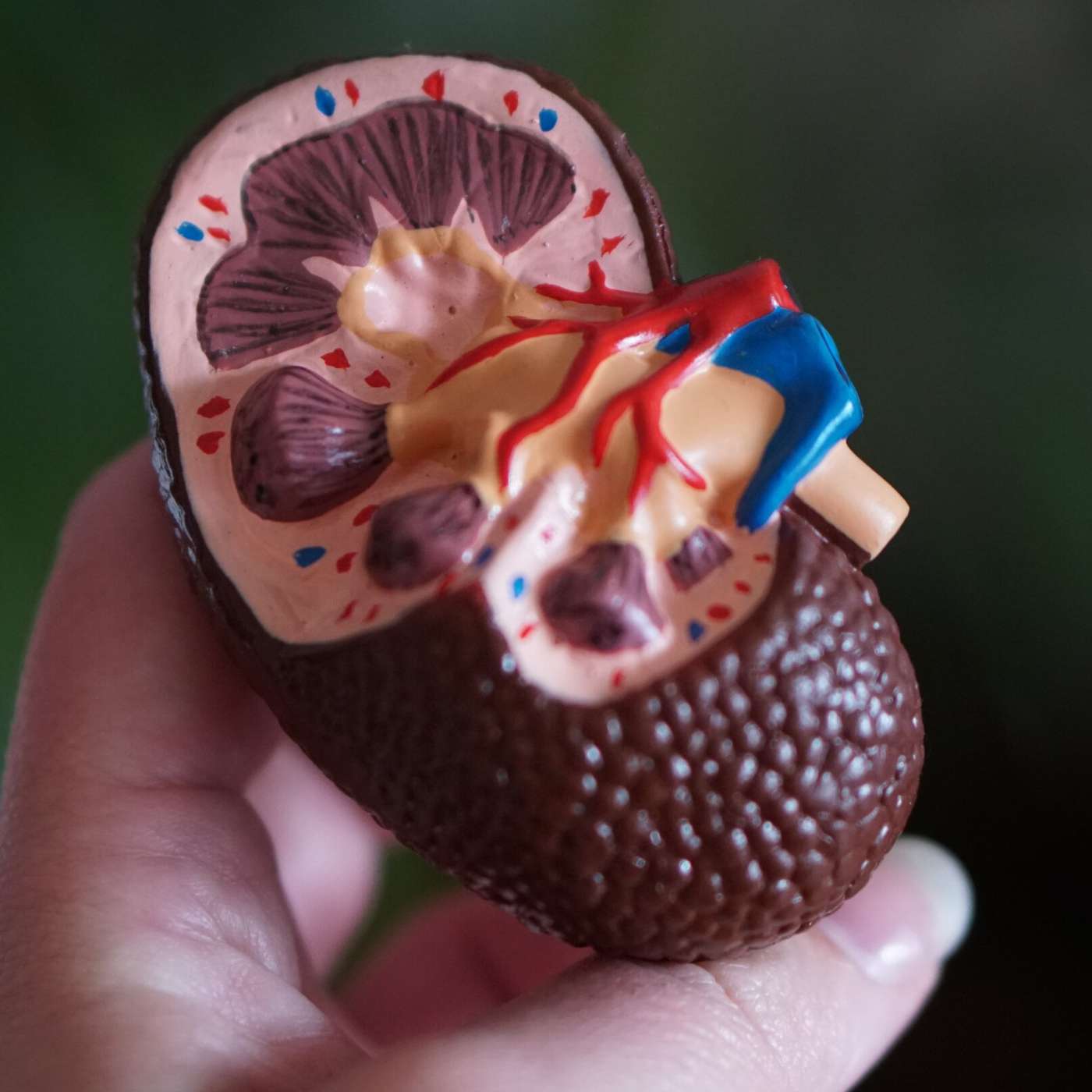 Roman Silver Mining Pollutes IQ, Biolaser Technique Enhances Cancer Detection, Study Links Loneliness to Health Risks, New Biomarkers Detect Kidney Injury, and more...