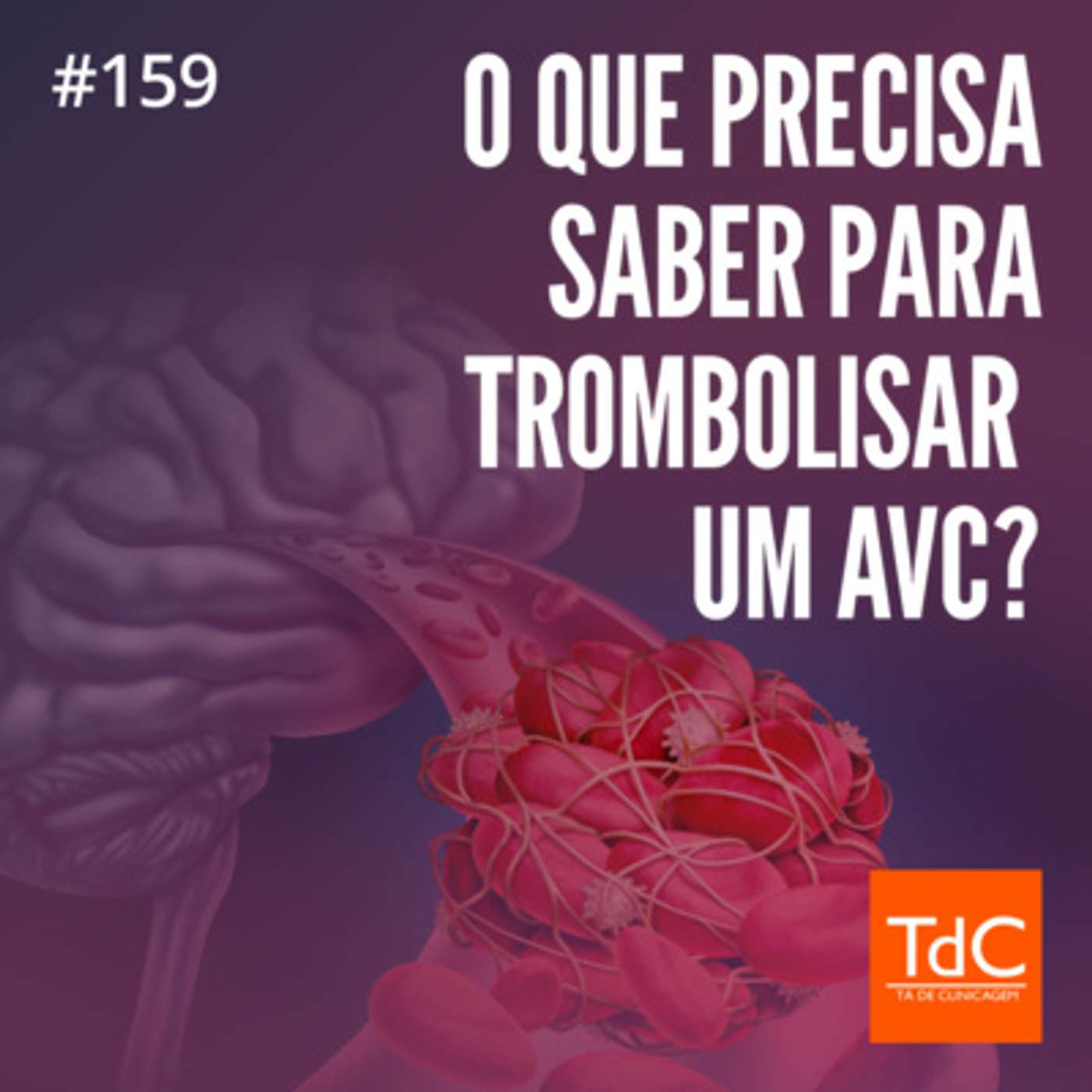 TdC 159: O que você precisa saber para trombolisar um AVC