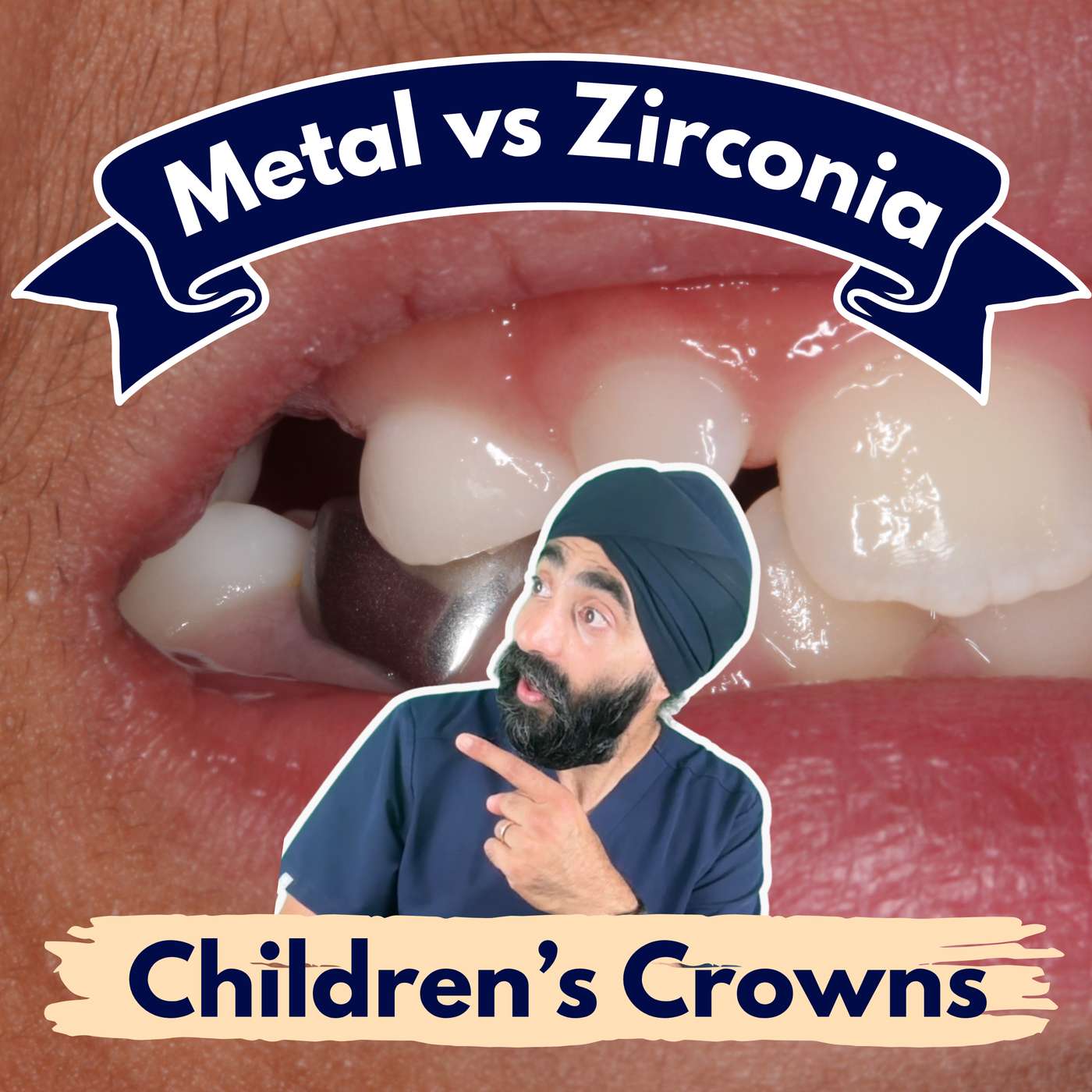 Zirconia vs Metal Hall Crowns vs Conventional with Dr Tim Keys – PDP227