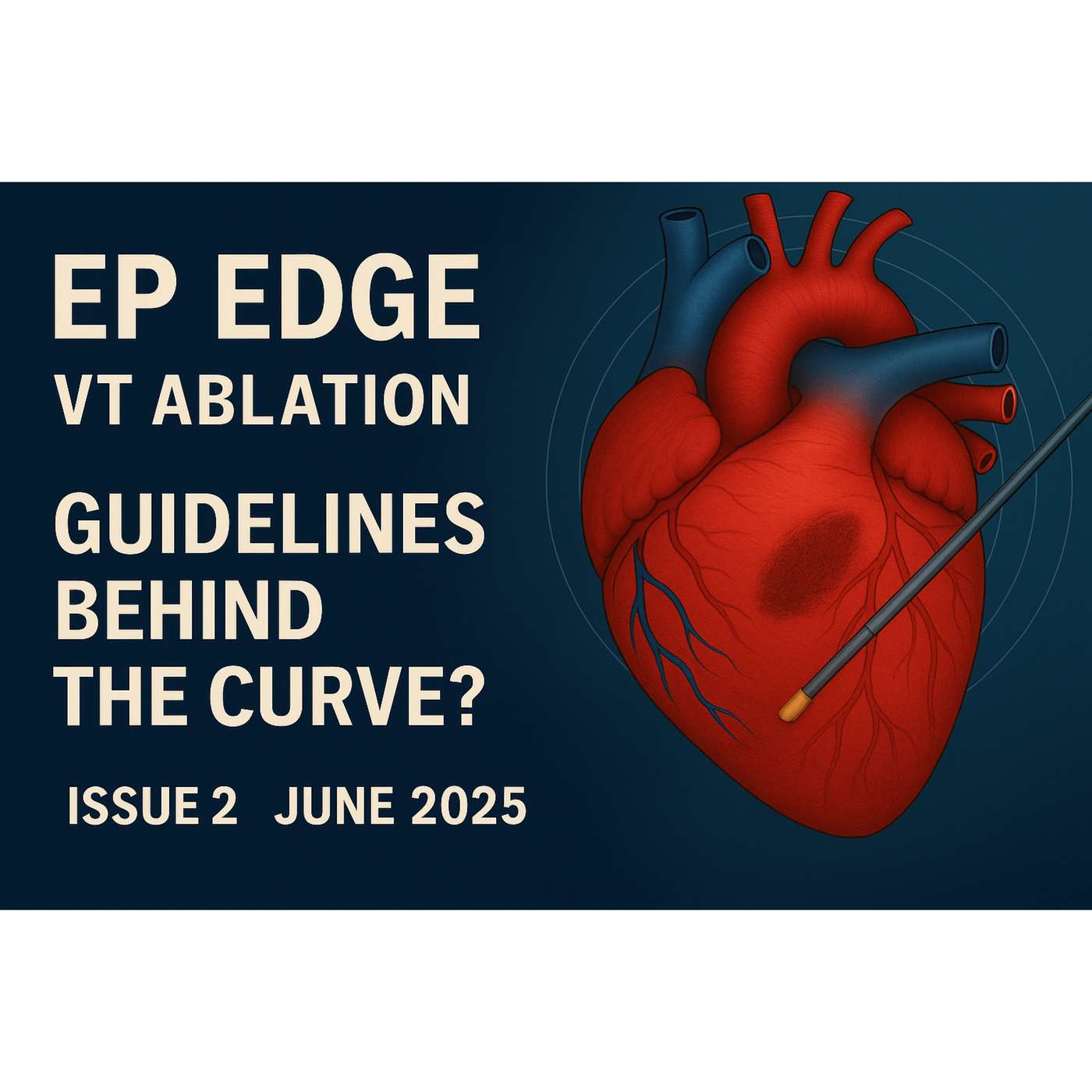 First-Line VT Ablation: Trials, Tools & Timing: EP Edge Newsletter June 2025