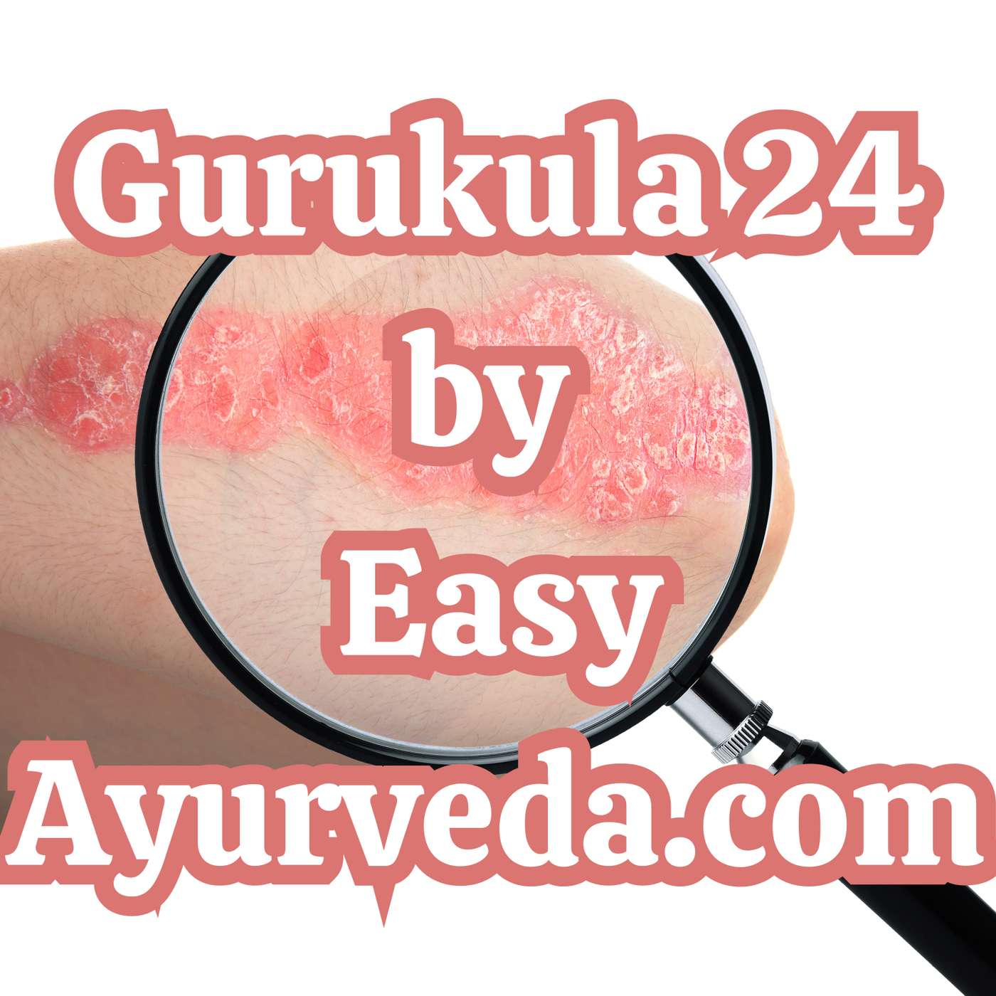 Gurukula 24: Case study Ayurvedic treatment of psoriasis | Two crucial signs of psoriasis episode artwork