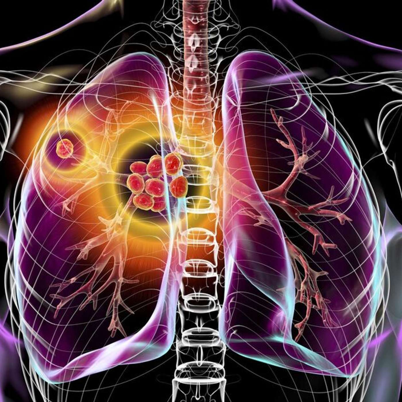 England Sees TB Case Surge, £11 Billion Rail Deal Unveiled, UK Universities Prepare for Job Cuts, Met Police Faces Protest Backlash, and more... episode artwork