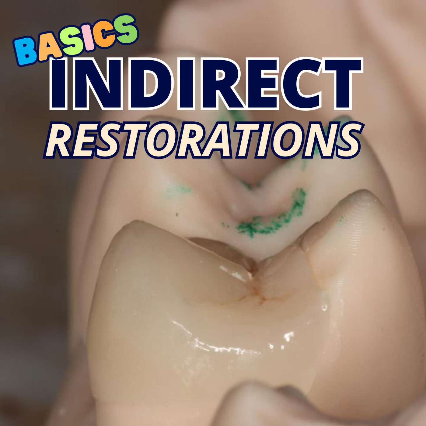 Basics of Indirect Restorations Part 1 – Decision Making – PS006 episode artwork