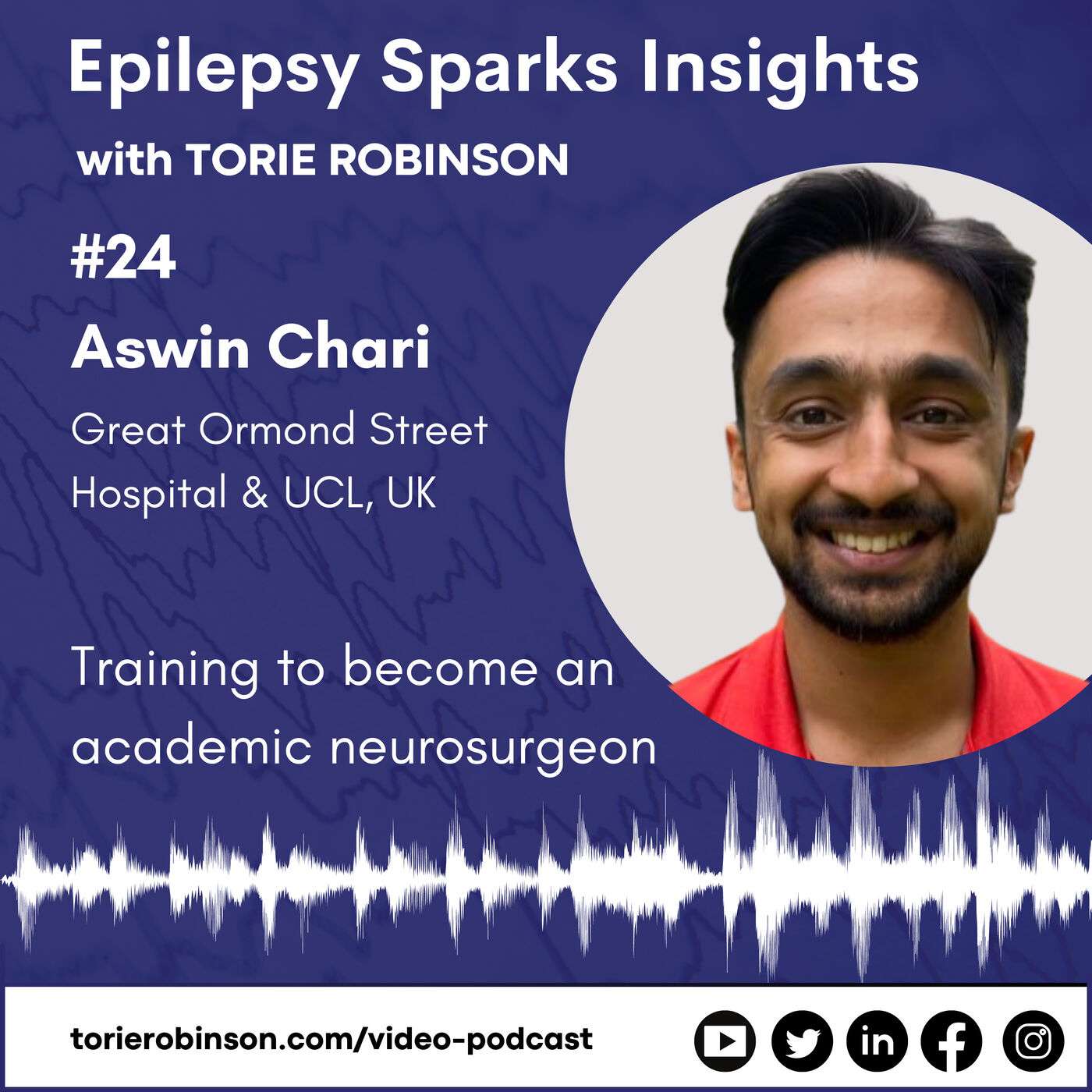 Epilepsy Sparks Insights