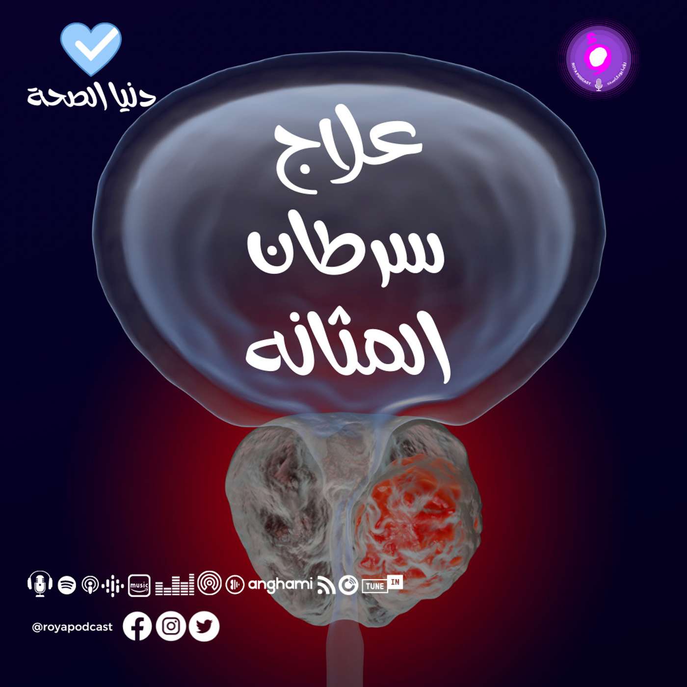 علاج سرطان المثانه