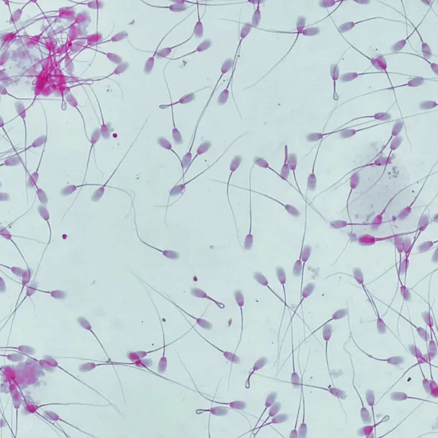 Cancer Mutation Donor Fathers 197 Kids, EU Targets 90 Emissions Cut, Ireland Unveils Digital Wallet Plan, EU Weighs Stricter Migration Rules, and more... Cancer Mutation Donor Fathers 197 Kids, EU Targets 90 Emissions Cut, Ireland Unveils Digital Wallet Plan, EU Weighs Stricter Migration Rules, and more...