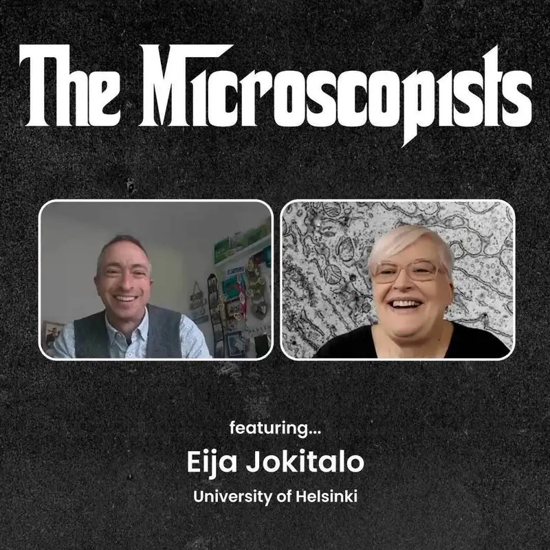 Eija Jokitalo (University of Helsinki)