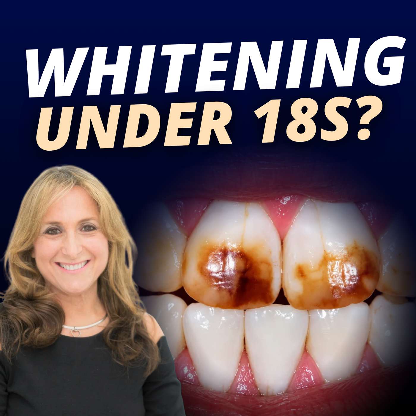 Finally, Some Clarity on Teeth Whitening for Under-18s with Linda Greenwall – PDP096 episode artwork