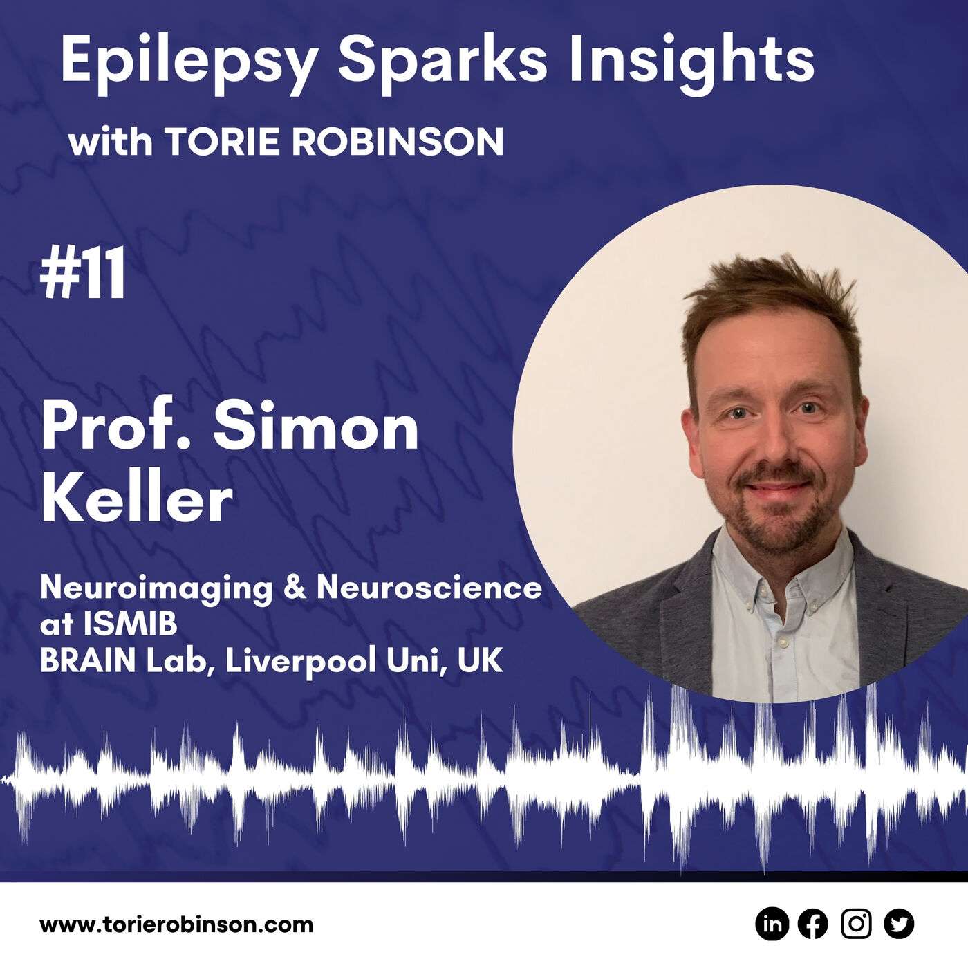Beautiful neuroimaging and epilepsy research - Professor Simon Keller episode artwork