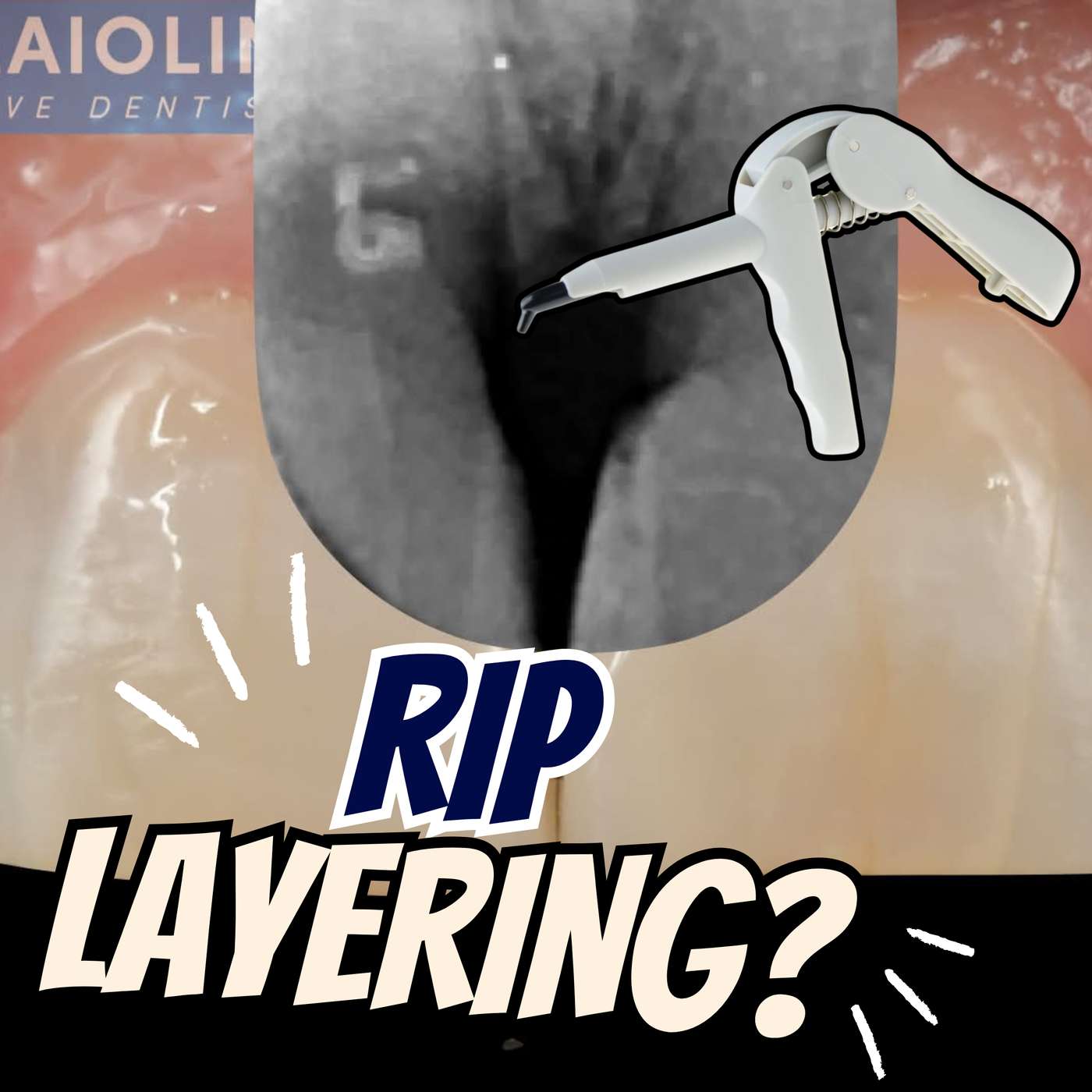 Why Injection Moulding Composite is Superior to Layering – PDP228