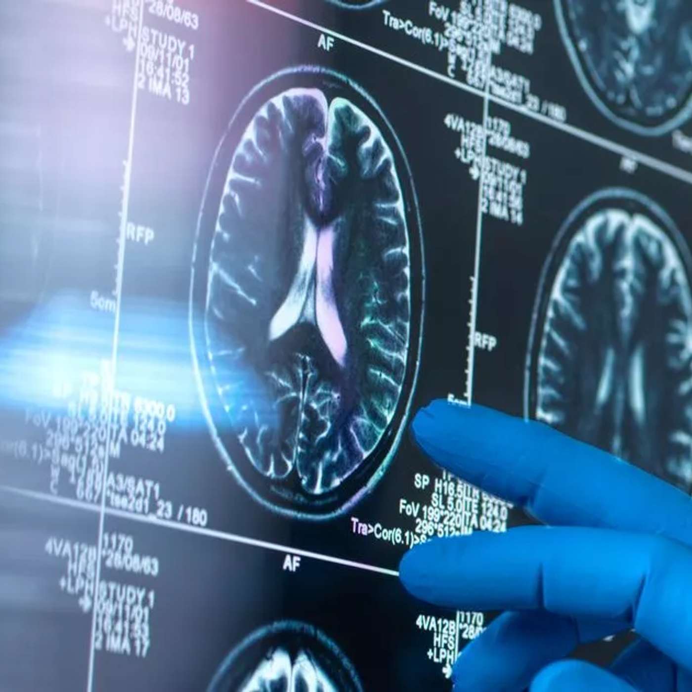 Study Links Obesity to Alzheimer's, Rare Whale Sparks Scientific Study, New Study Disproves Wet Venus Theory, E-Tattoo Revolutionizes Brain Monitoring, and more...