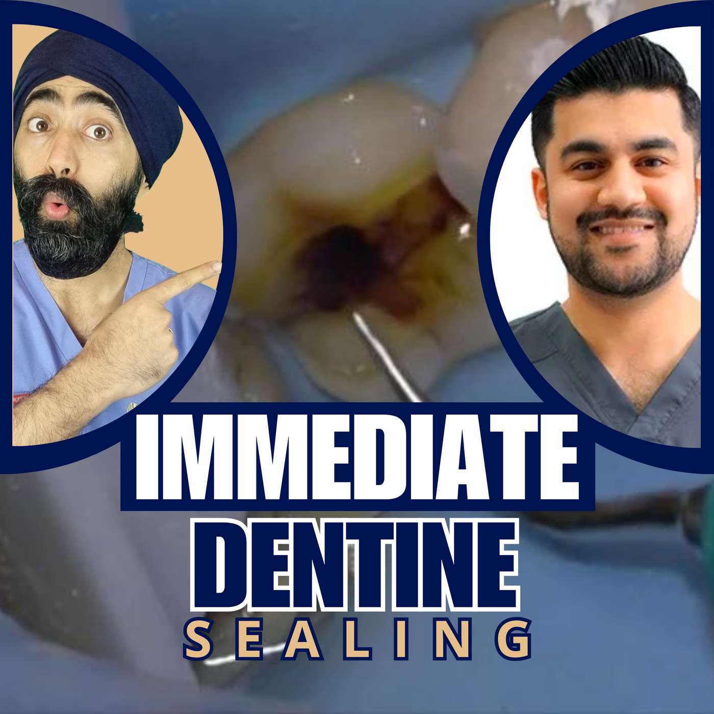 Immediate Dentine Sealing Tutorial Part 1 – PDP173 episode artwork