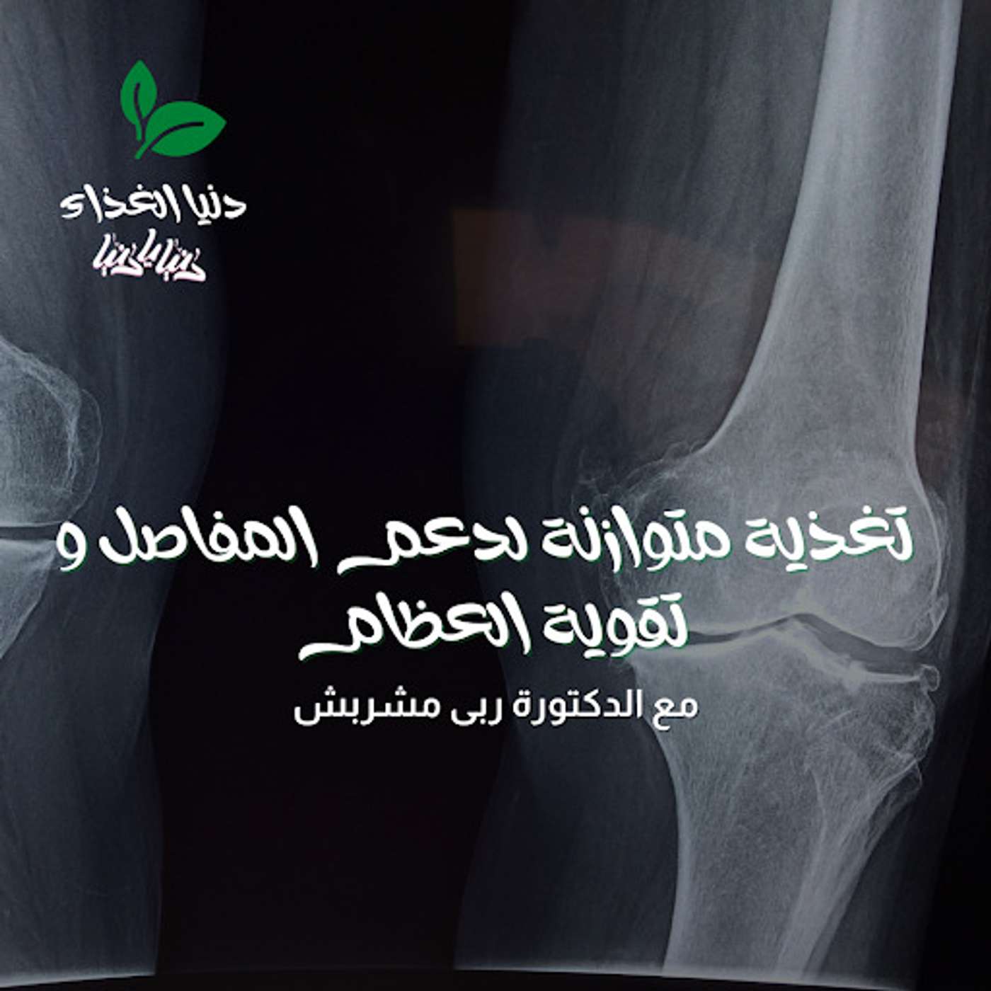 تغذية متوازنة لدعم المفاصل و تقوية العظام