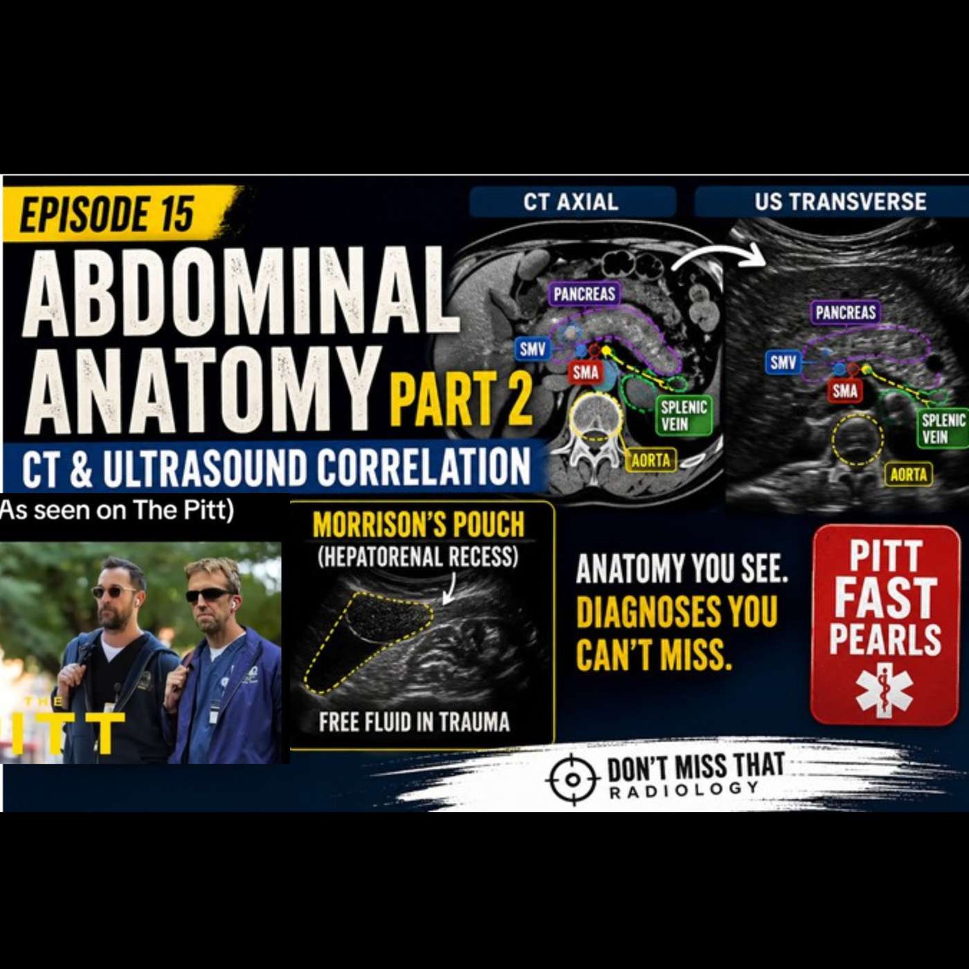 Abdominal anatomy: CT & ultrasound Anatomy Pearls to Impress on Rotations (and while watching The Pitt) episode artwork
