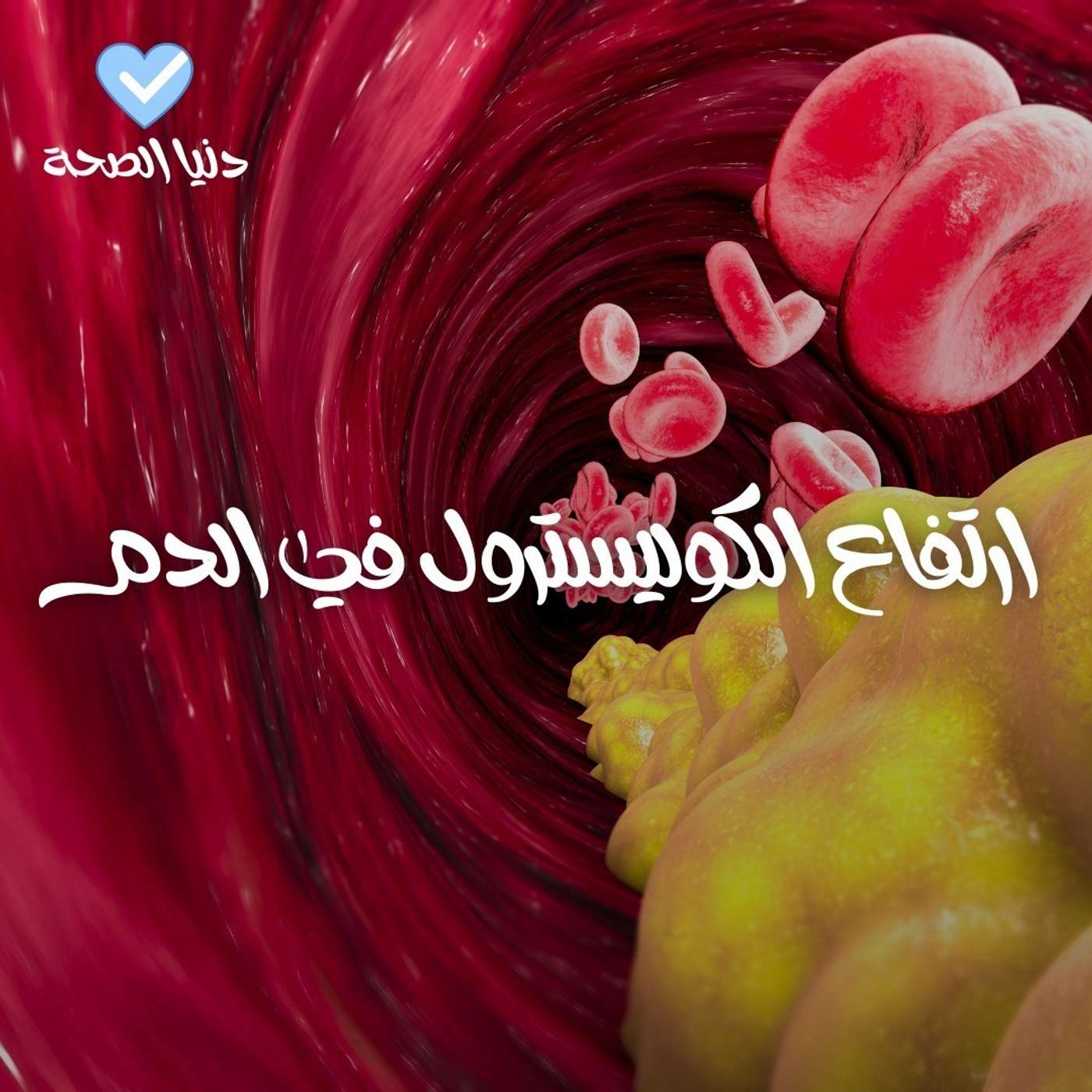 إرتفاع الكوليسترول في الدم