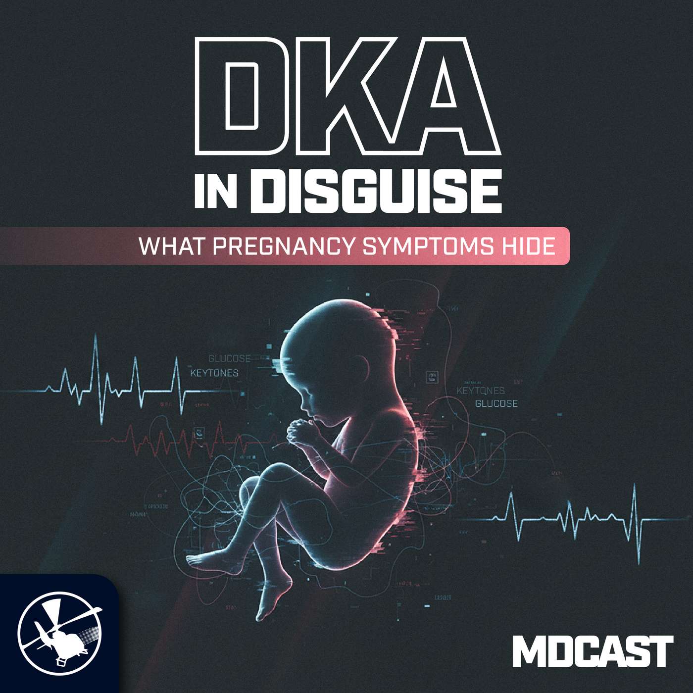 MDCast: DKA in Disguise | What Pregnancy Symptoms Hide
