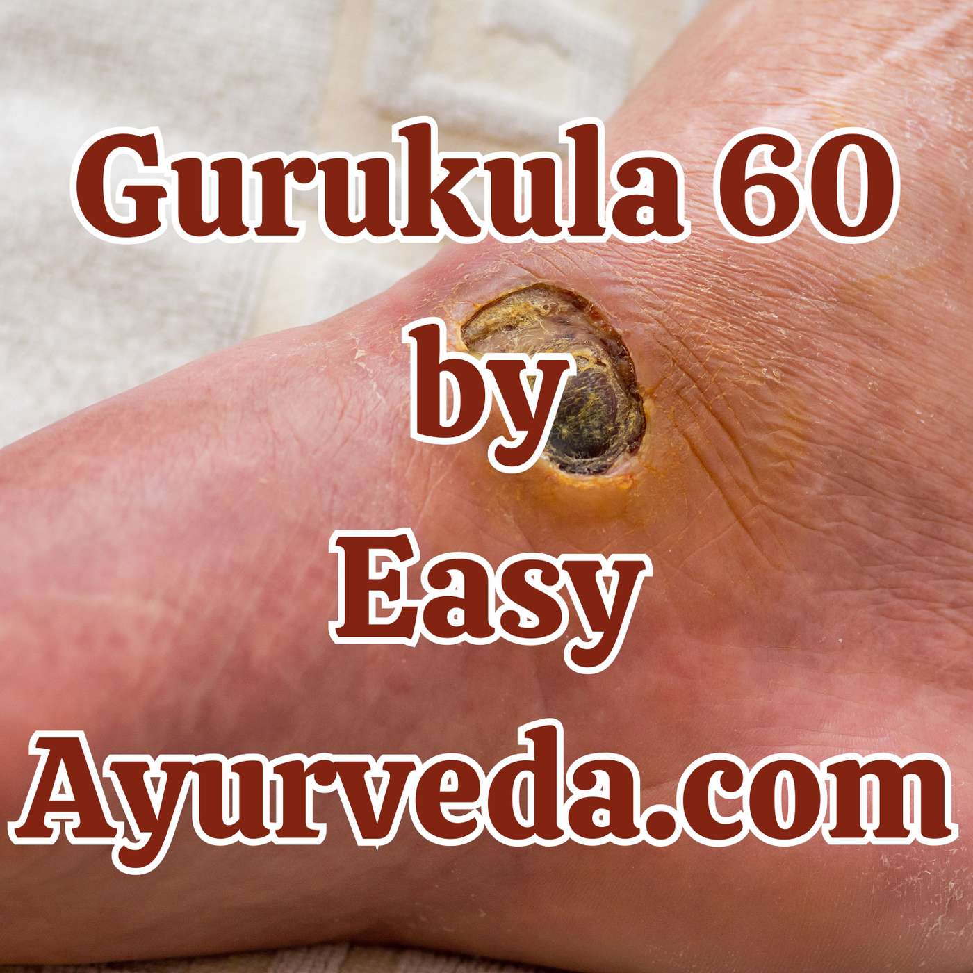Gurukula 60: “Dhoopana Karma in Dushta Vrana” episode artwork