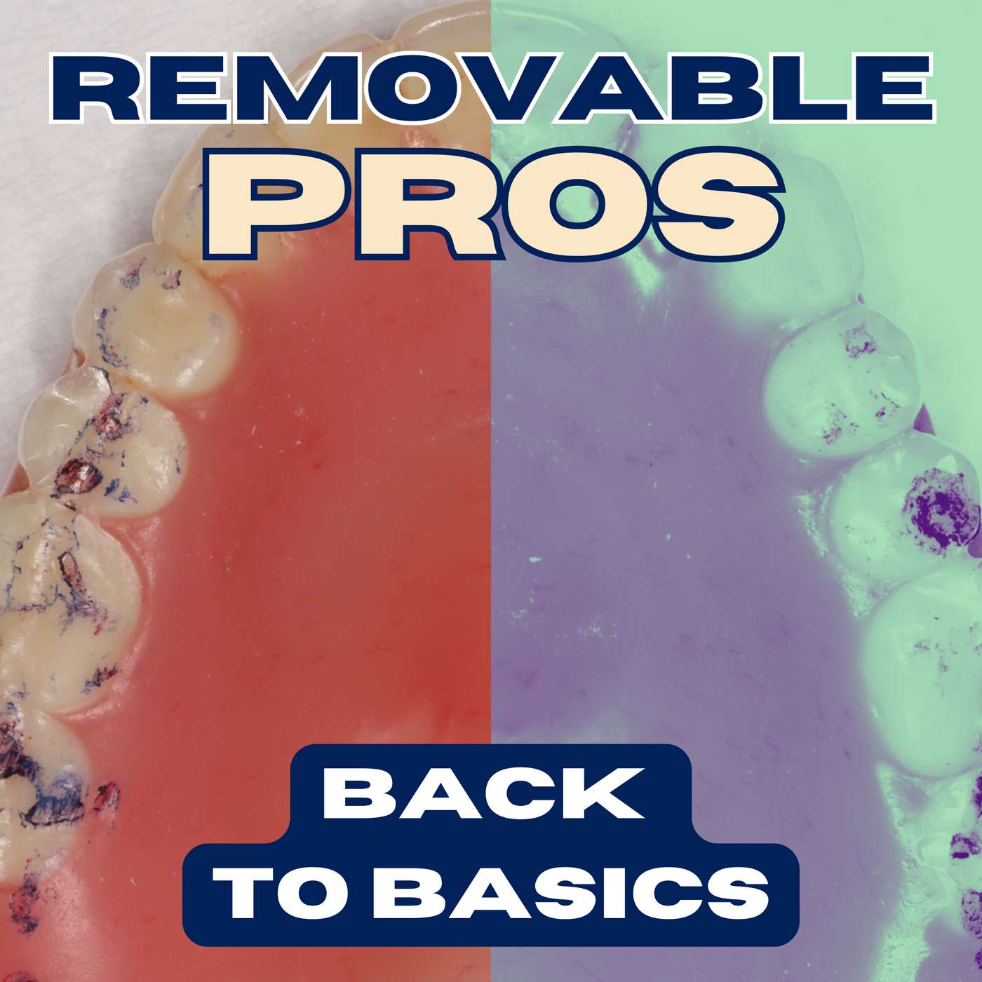 Removable Pros for Students – PS009 episode artwork