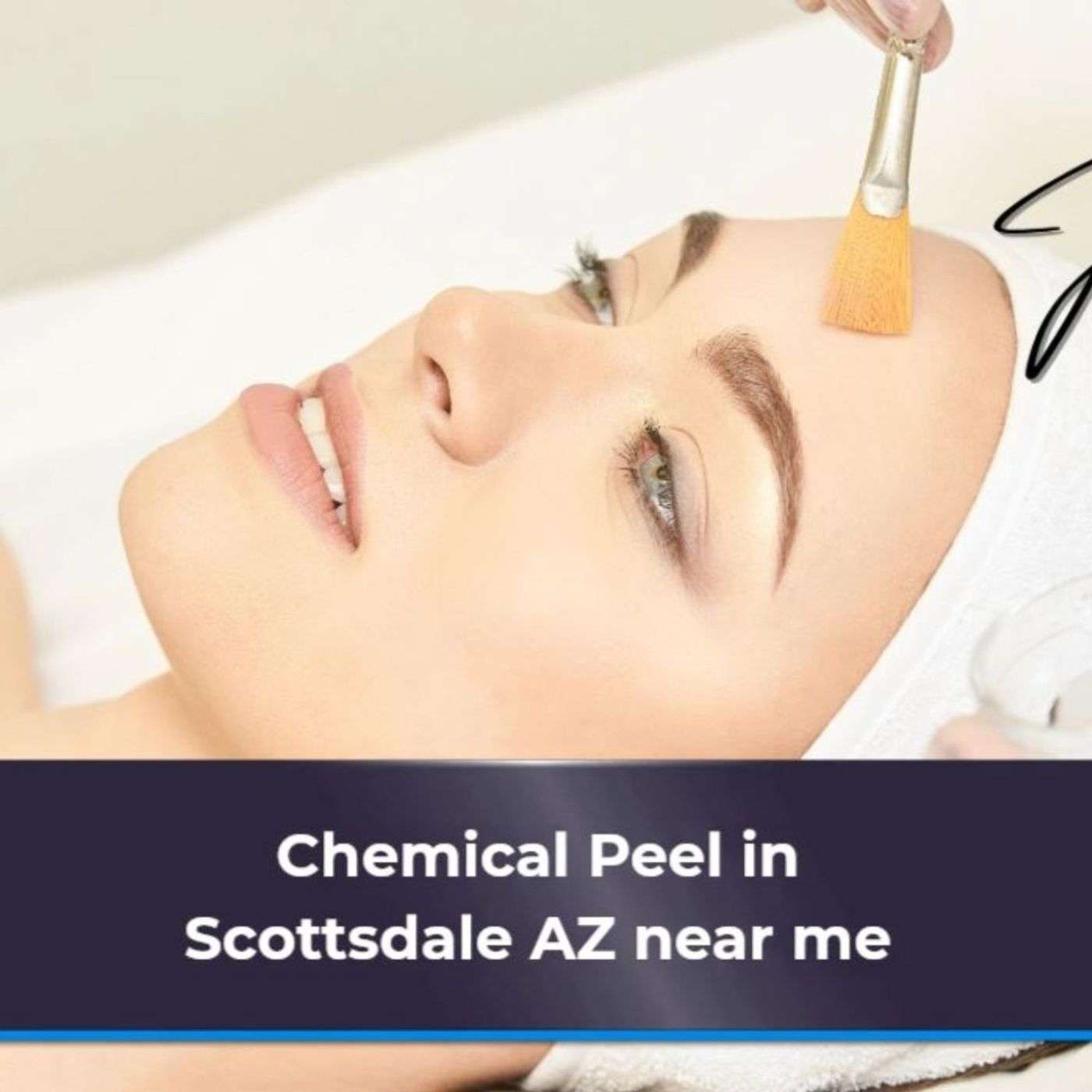 Chemical Peel in Scottsdale episode artwork