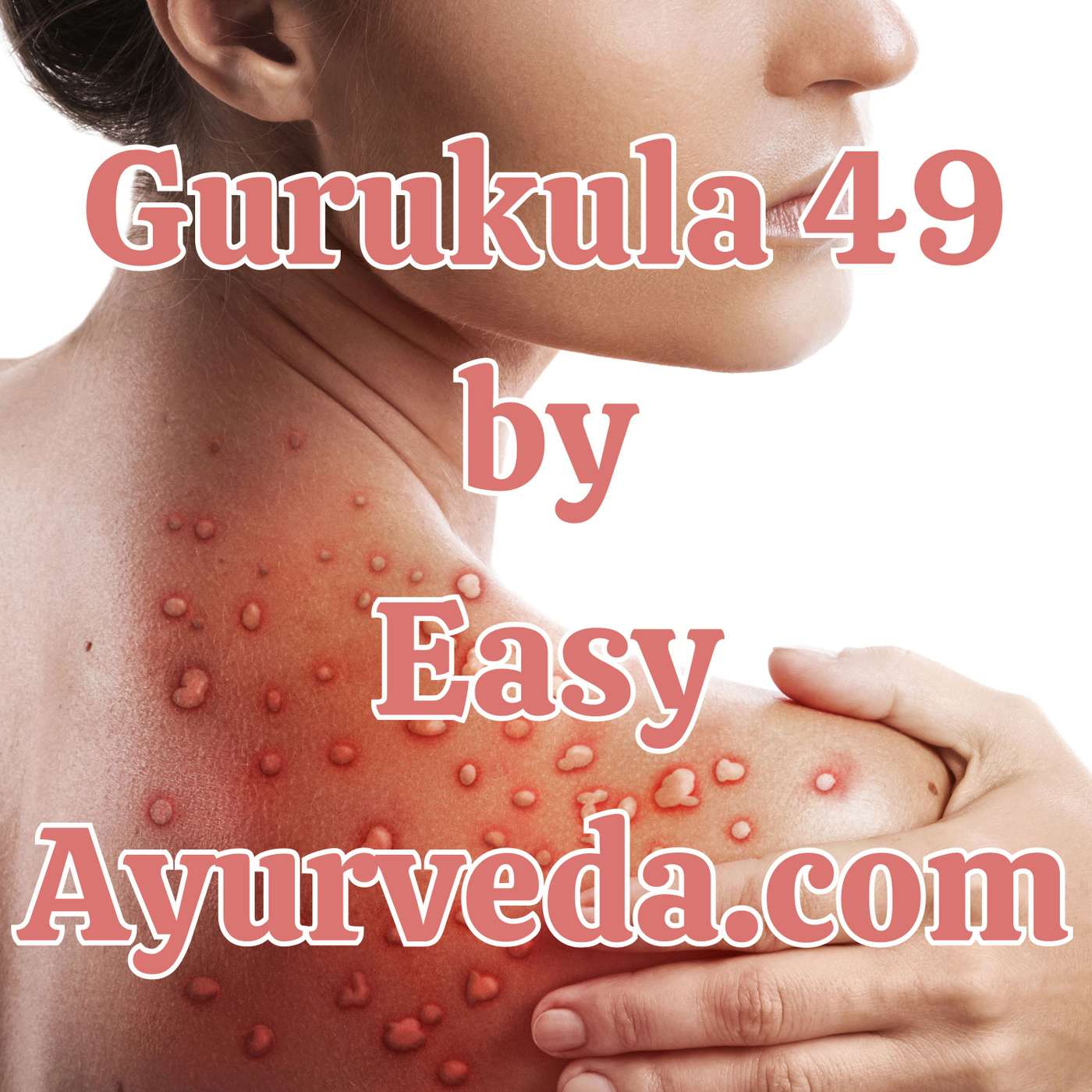 Gurukula 49: Ayurvedic Management of Pityriasis Lichenoides (PLEVA): Comprehensive Case Study Analysis and Therapeutic Insights episode artwork