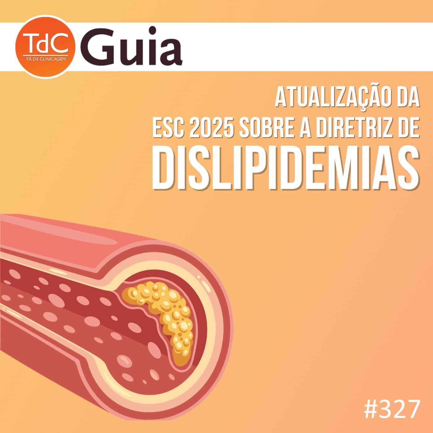 TdC 327: Atualização Diretriz Dislipidemia ESC 2025