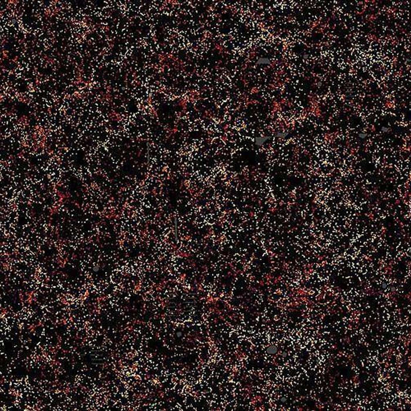 Urgent Action on Neurological Disorders, Staph Bacteria Worsen Sinus Inflammation, Universe without Dark Matter, rTMS Boosts Brain Plasticity, and more...