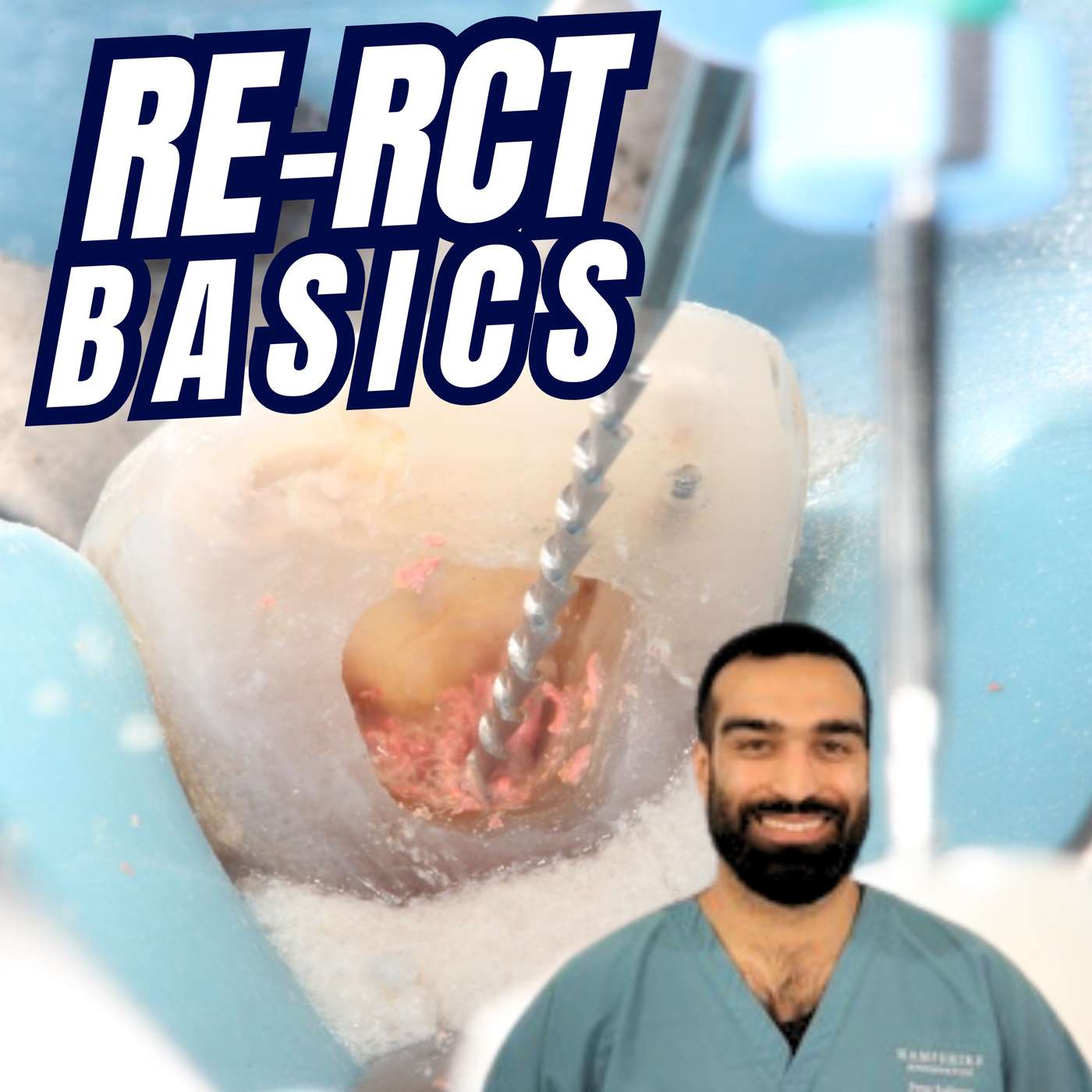 Simple Re-RCT Cases – ‘How To’ Guide – PDP233