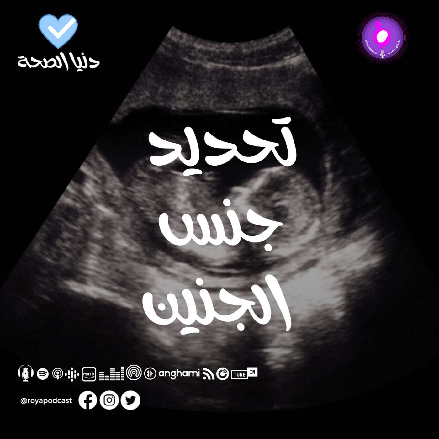 تحديد جنس الجنين