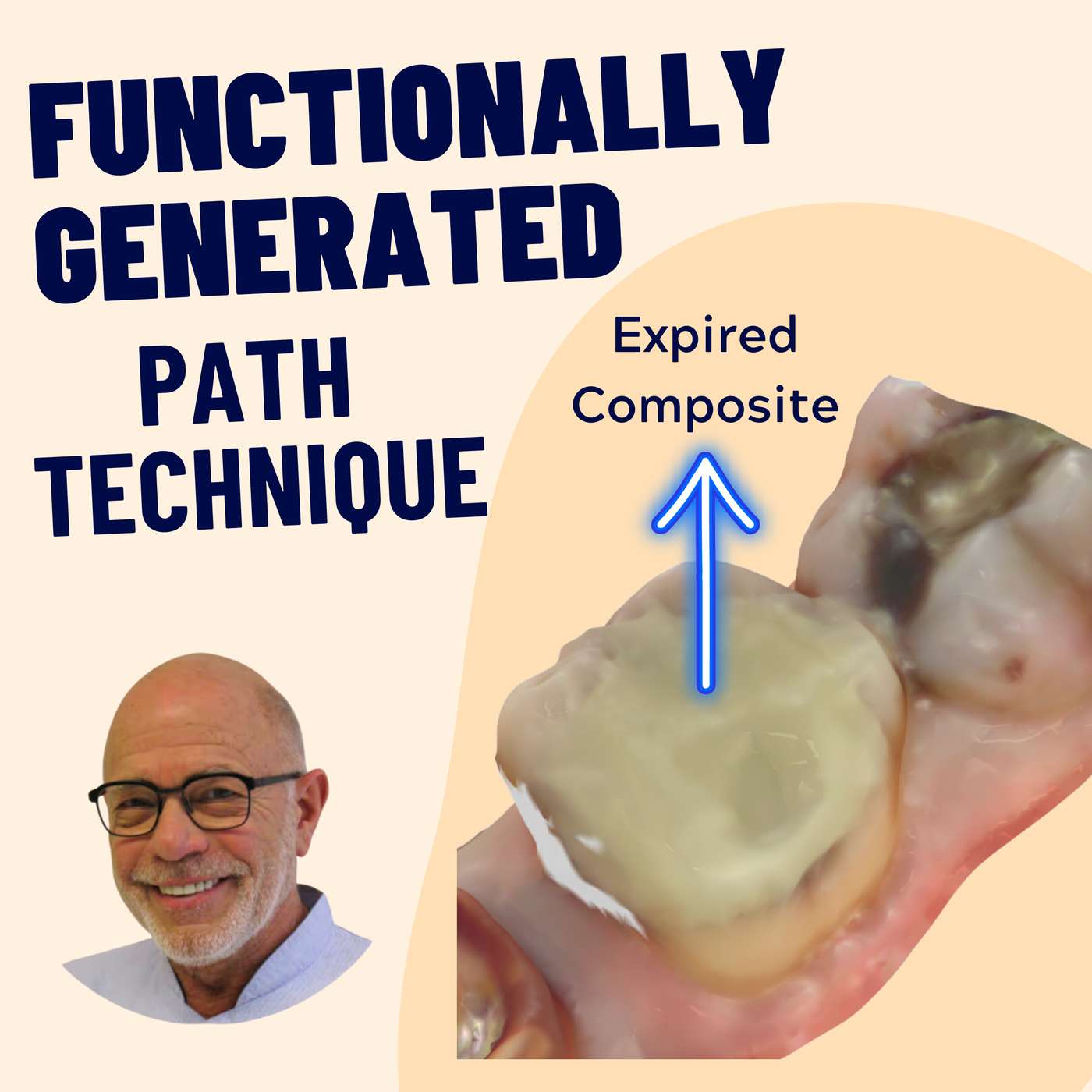 Functionally Generated Path Technique – Conforming to Funky Occlusions – PDP168 episode artwork