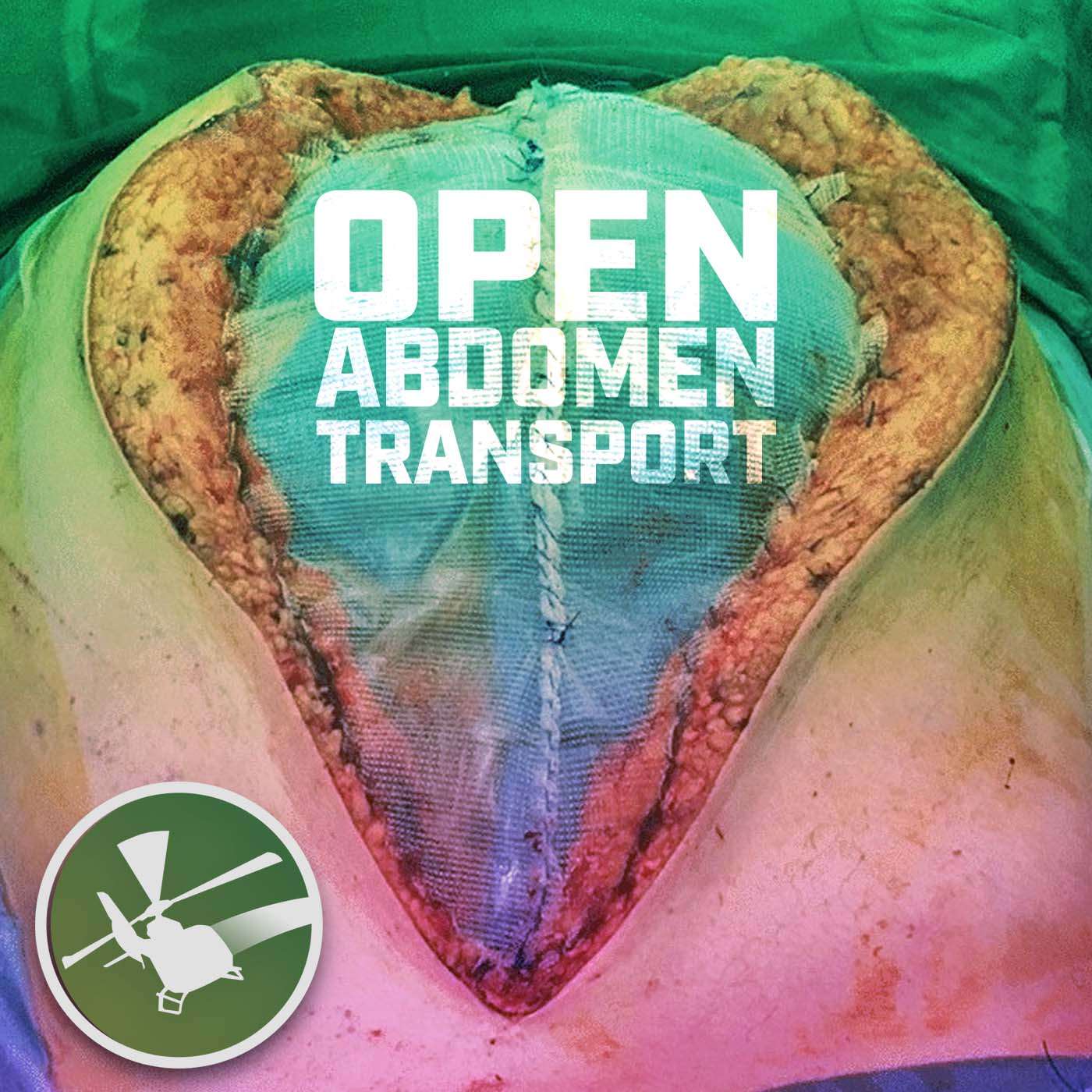 MDCAST: Open Abdomen Transport