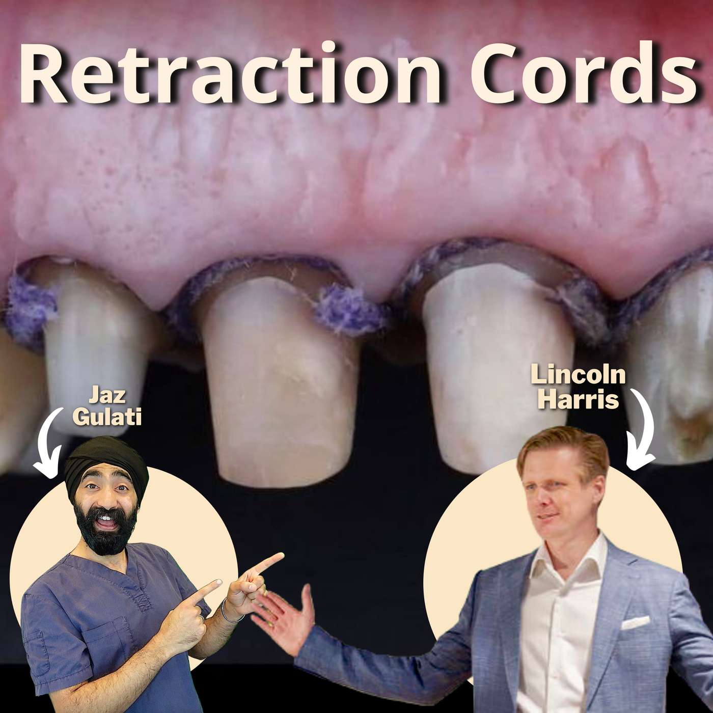 Retraction Cords and Subgingival Dentistry with Lincoln Harris – PDP124 episode artwork