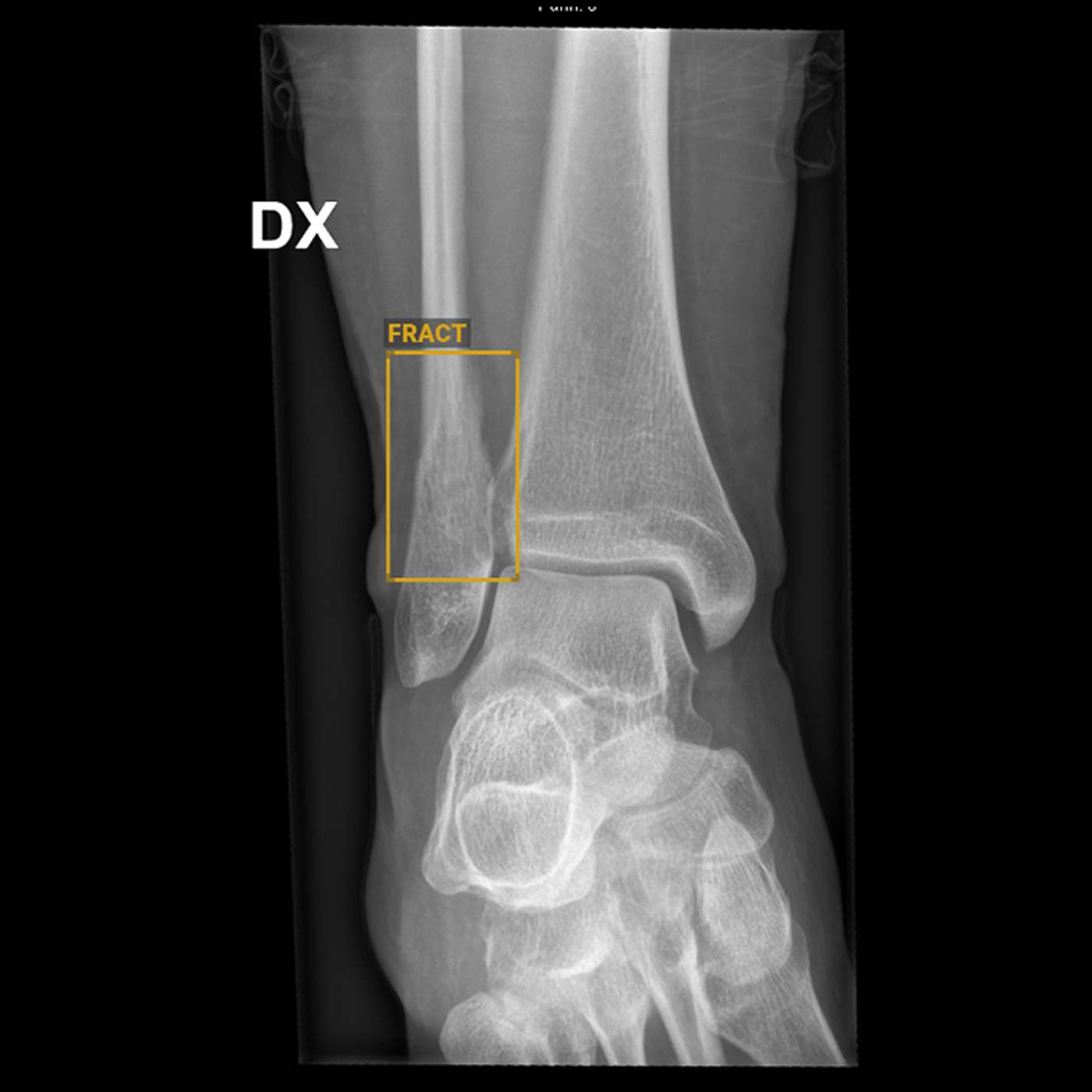 Bruk av KI i bildediagnostikk Bruk av KI i bildediagnostikk