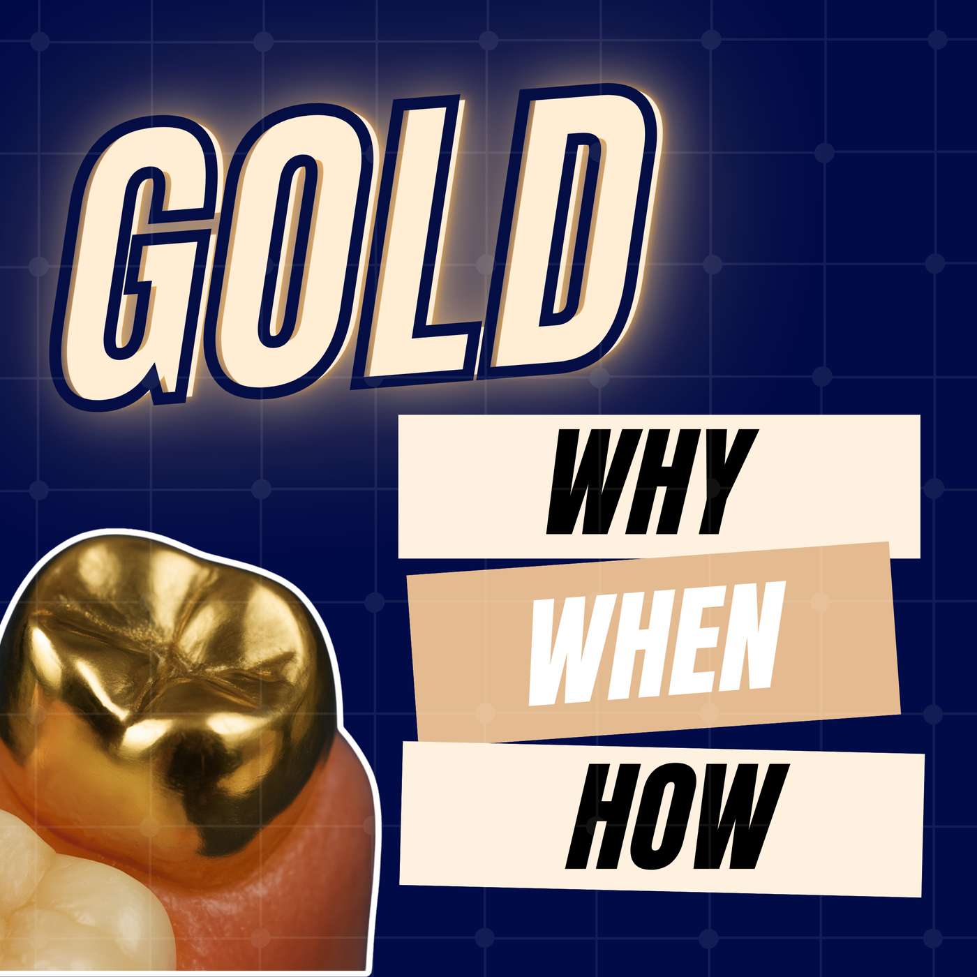 Gold Restorations: Why, When, and How with Lane Ochi – PDP236