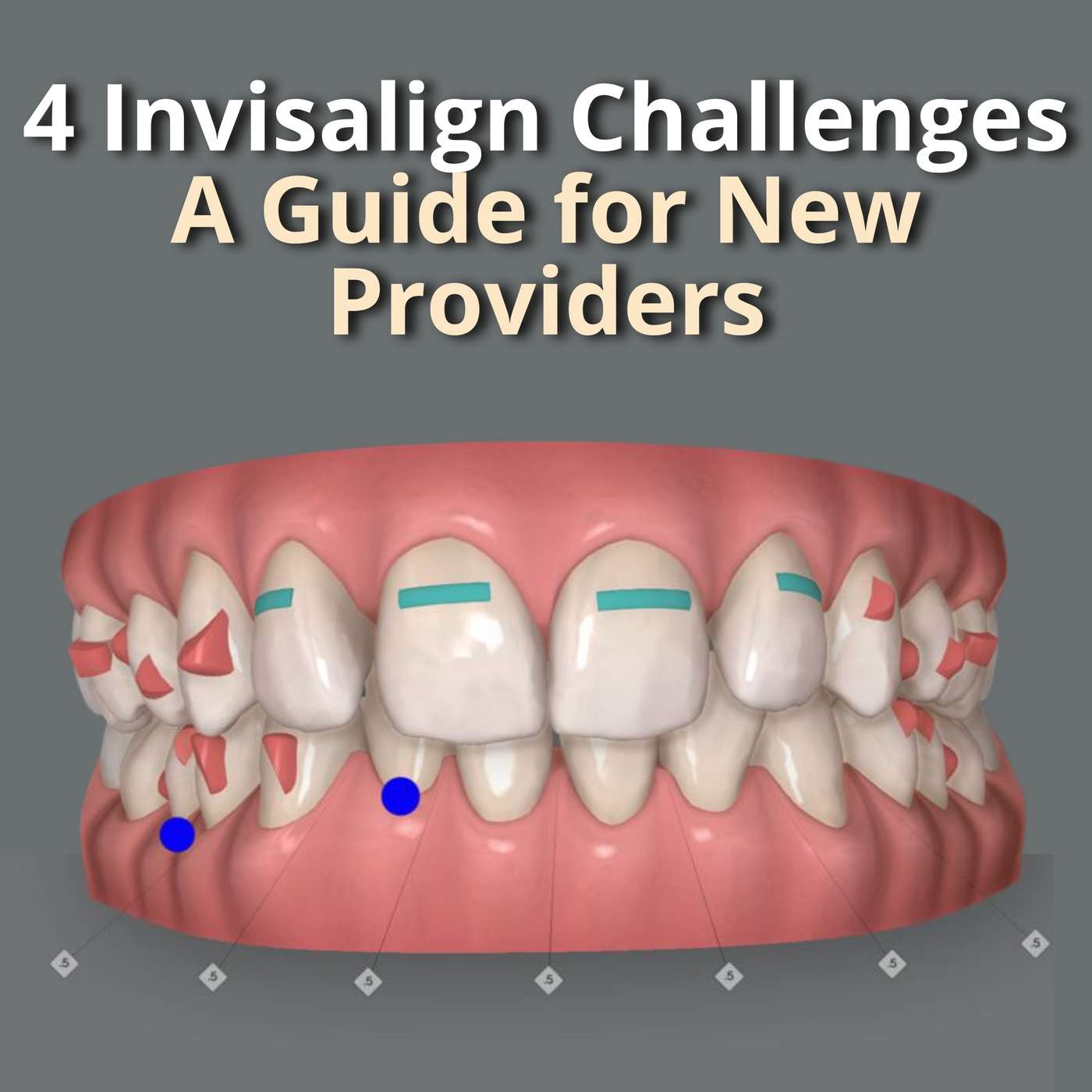4 Invisalign Challenges – A Guide for New Providers – PDP116 episode artwork